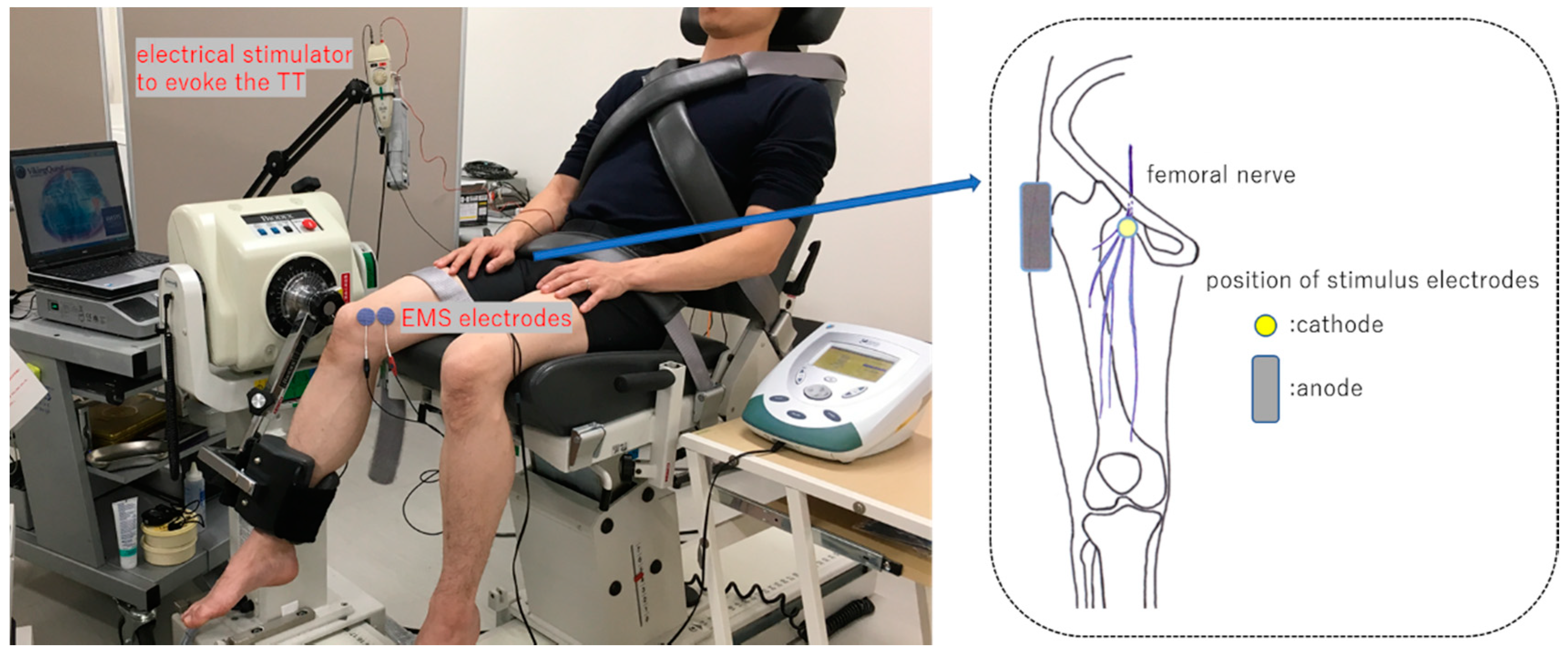 Jfmk Free Full Text Function Of The Distal Part Of The Vastus Medialis Muscle As A Generator Of Knee Extension Twitch Torque Jfmk Free Full Text Function Of The Distal Part Of The Vastus Medialis Muscle As A Generator Of Knee Extension Twitch Torque