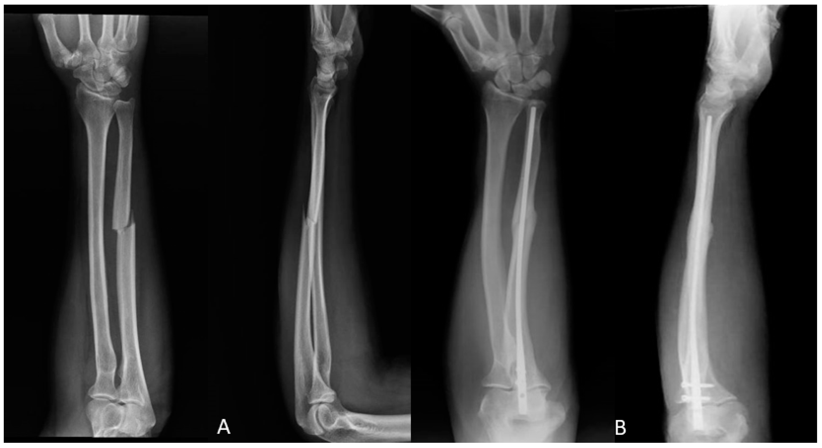 Jfmk 06 00046 g002 Jfmk 06 00046 g002