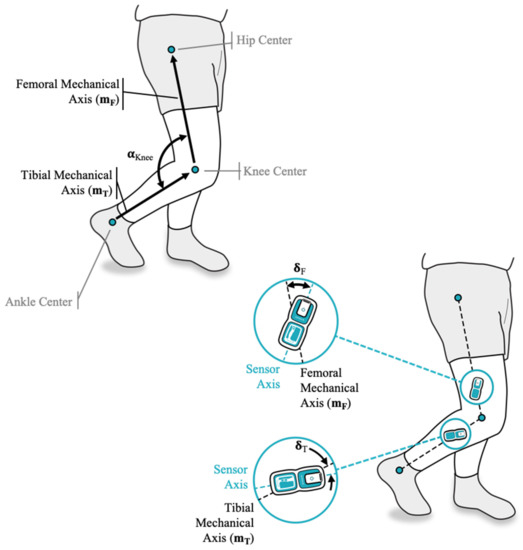 JFMK Free FullText Accuracy of Measuring Knee Flexion after TKA through Wearable IMU Sensors