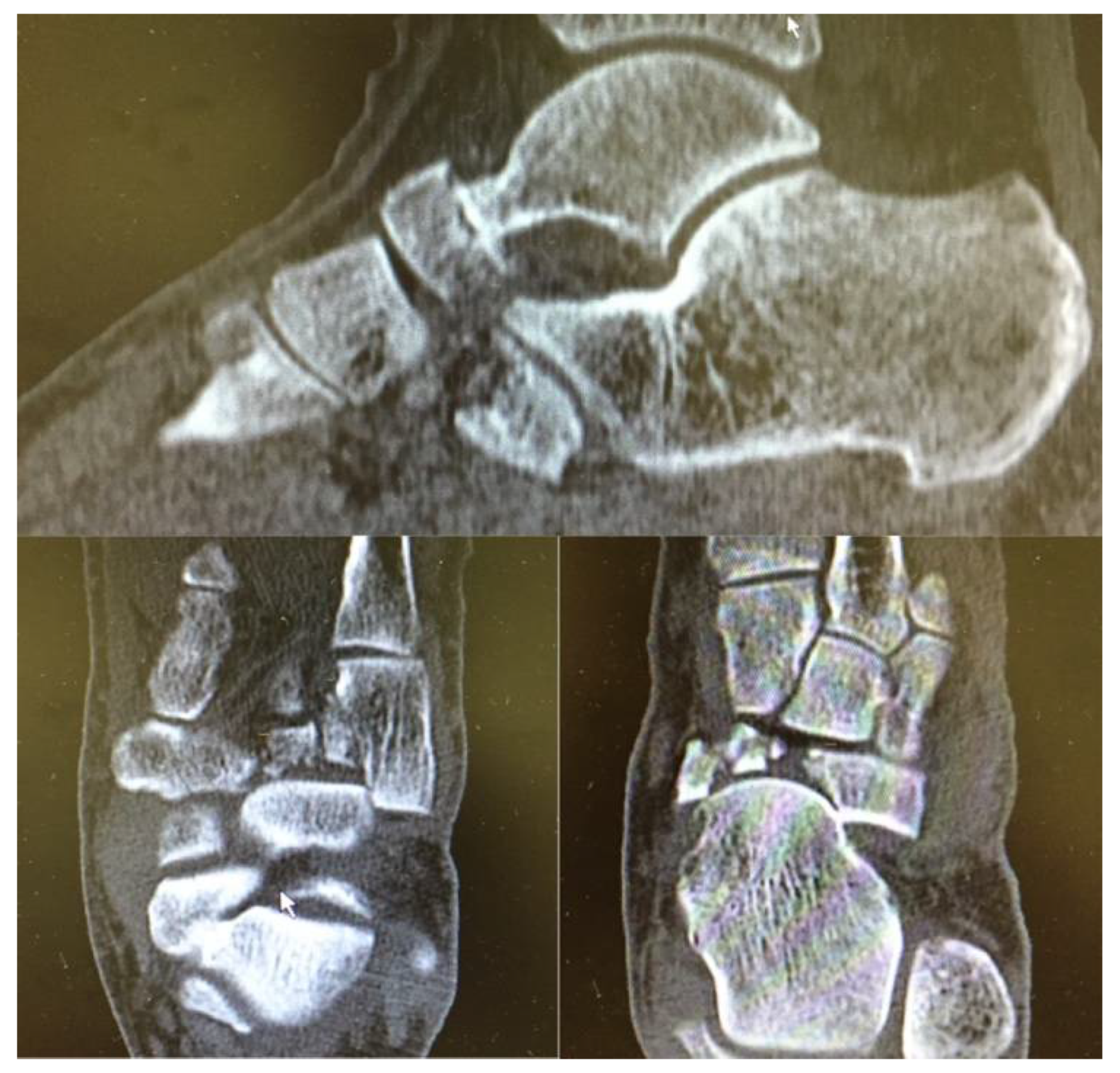 Jfmk 06 00099 g002 Jfmk 06 00099 g002