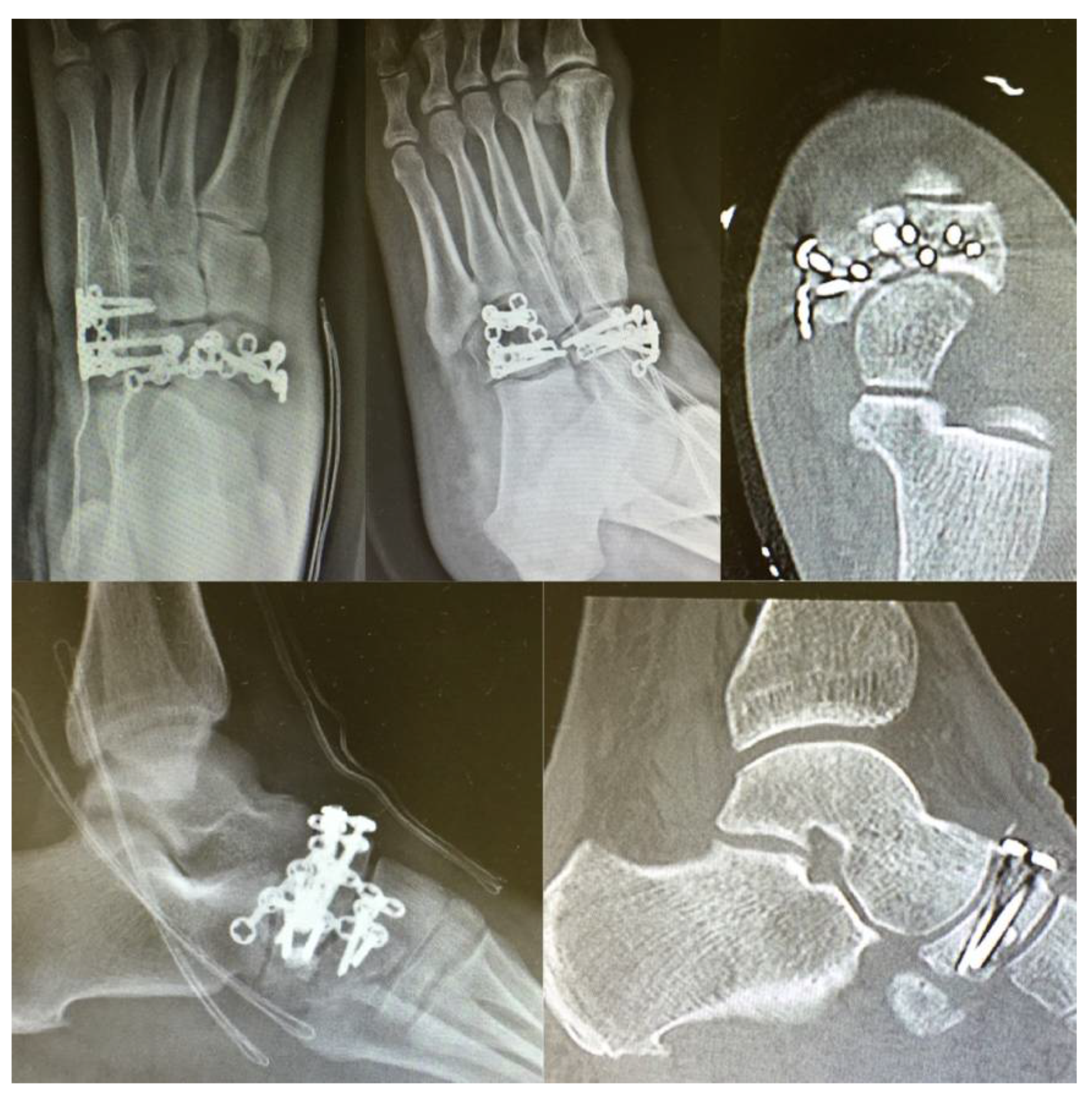 Jfmk 06 00099 g004 Jfmk 06 00099 g004