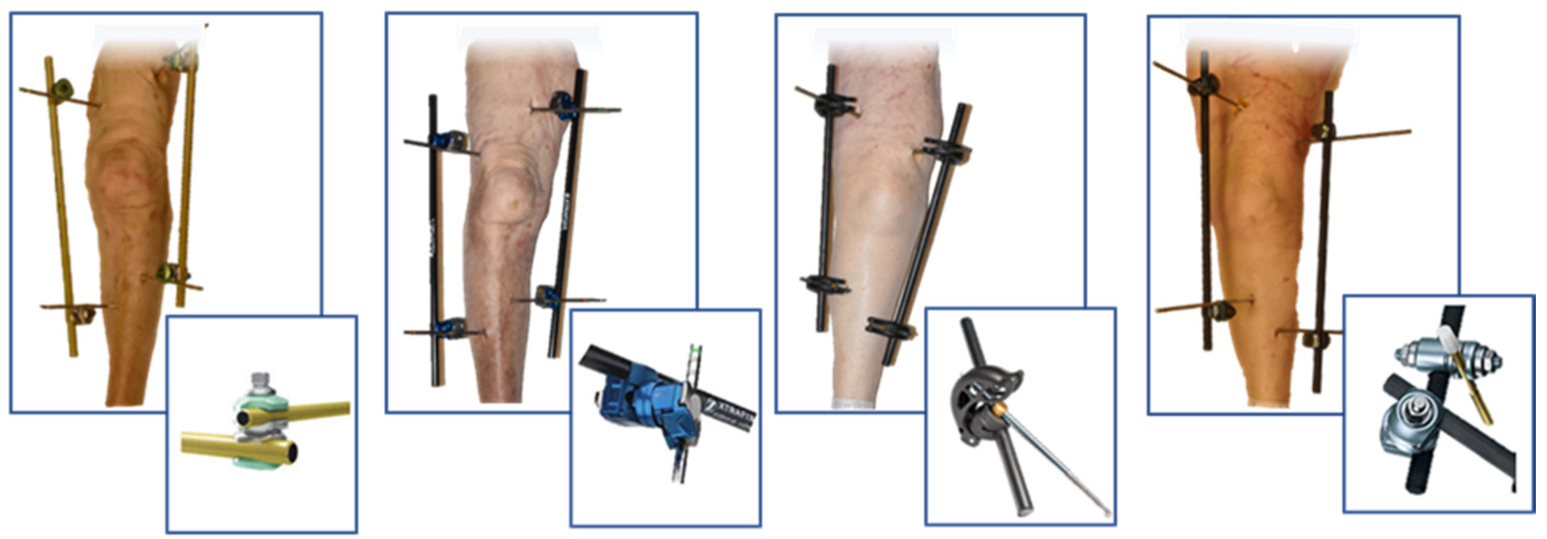 Posters Yup unknown JFMK | Free Full-Text | Magnetic Resonance Imaging of the Knee in the Presence of Bridging External Fixation: A Comparative Experimental Evaluation of Four External Fixators, Including Dolphix® | HTML Posters Yup unknown JFMK | Free Full-Text | Magnetic Resonance Imaging of the Knee in the Presence of Bridging External Fixation: A Comparative Experimental Evaluation of Four External Fixators, Including Dolphix® | HTML