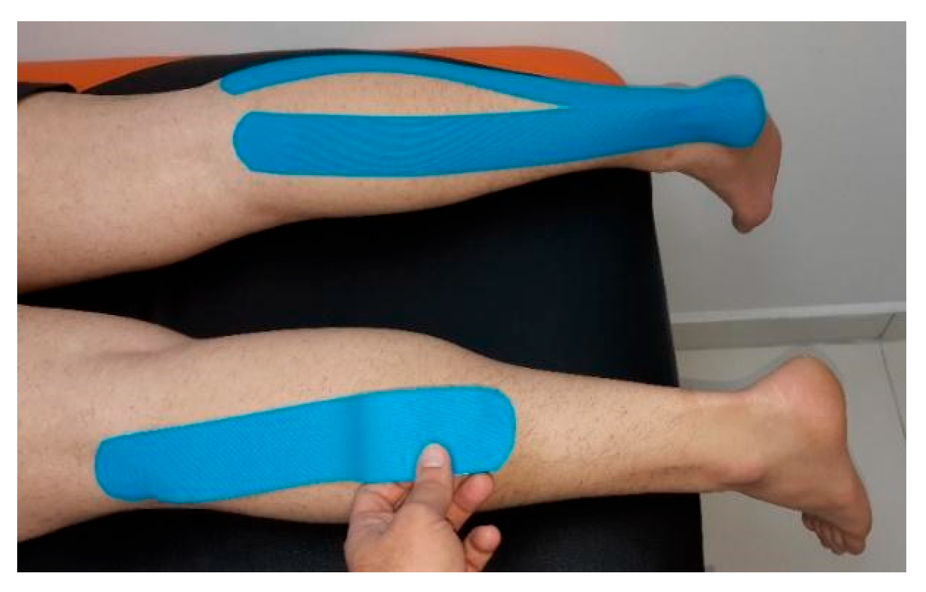 The Human Knee: Anatomy & Clinic, and the Benefits of Kinesio Taping