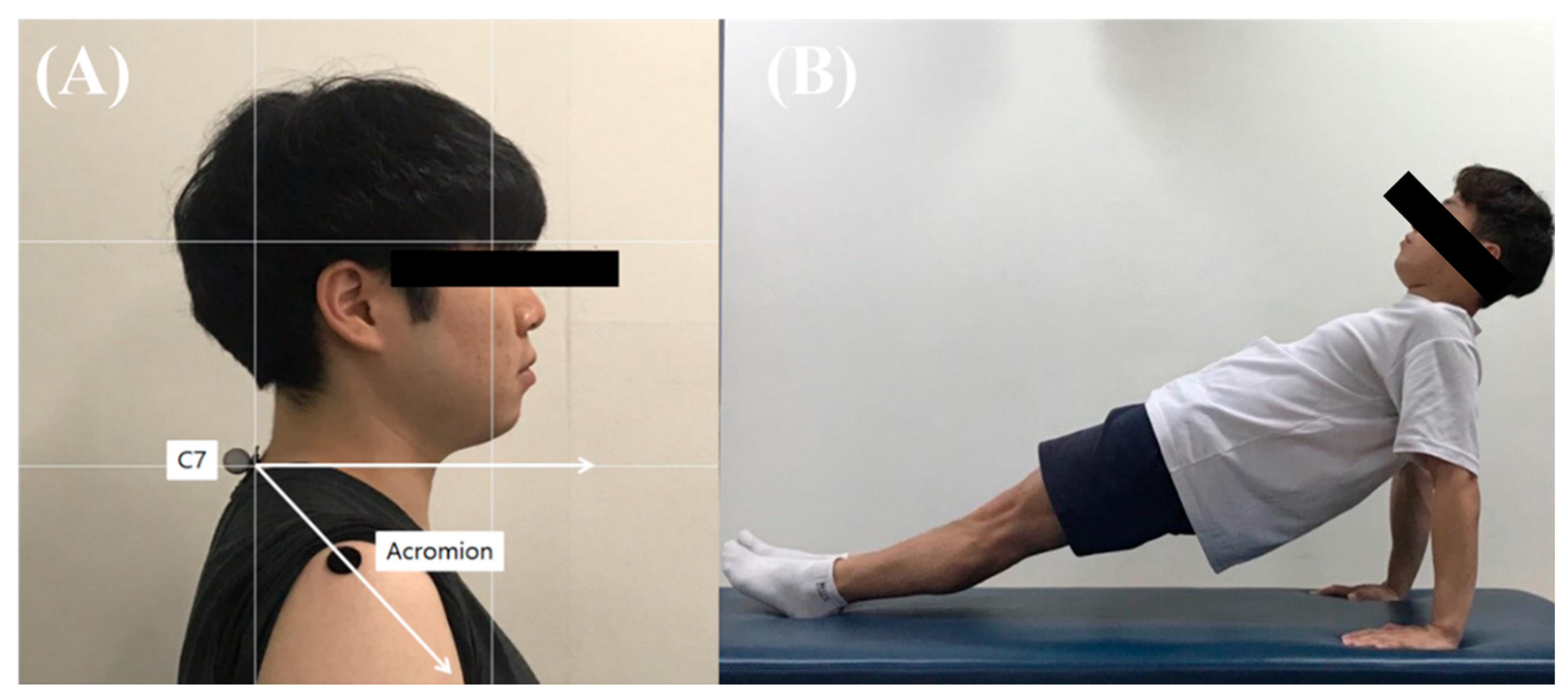 Measure posture — SPP was measured on four positions (supine position