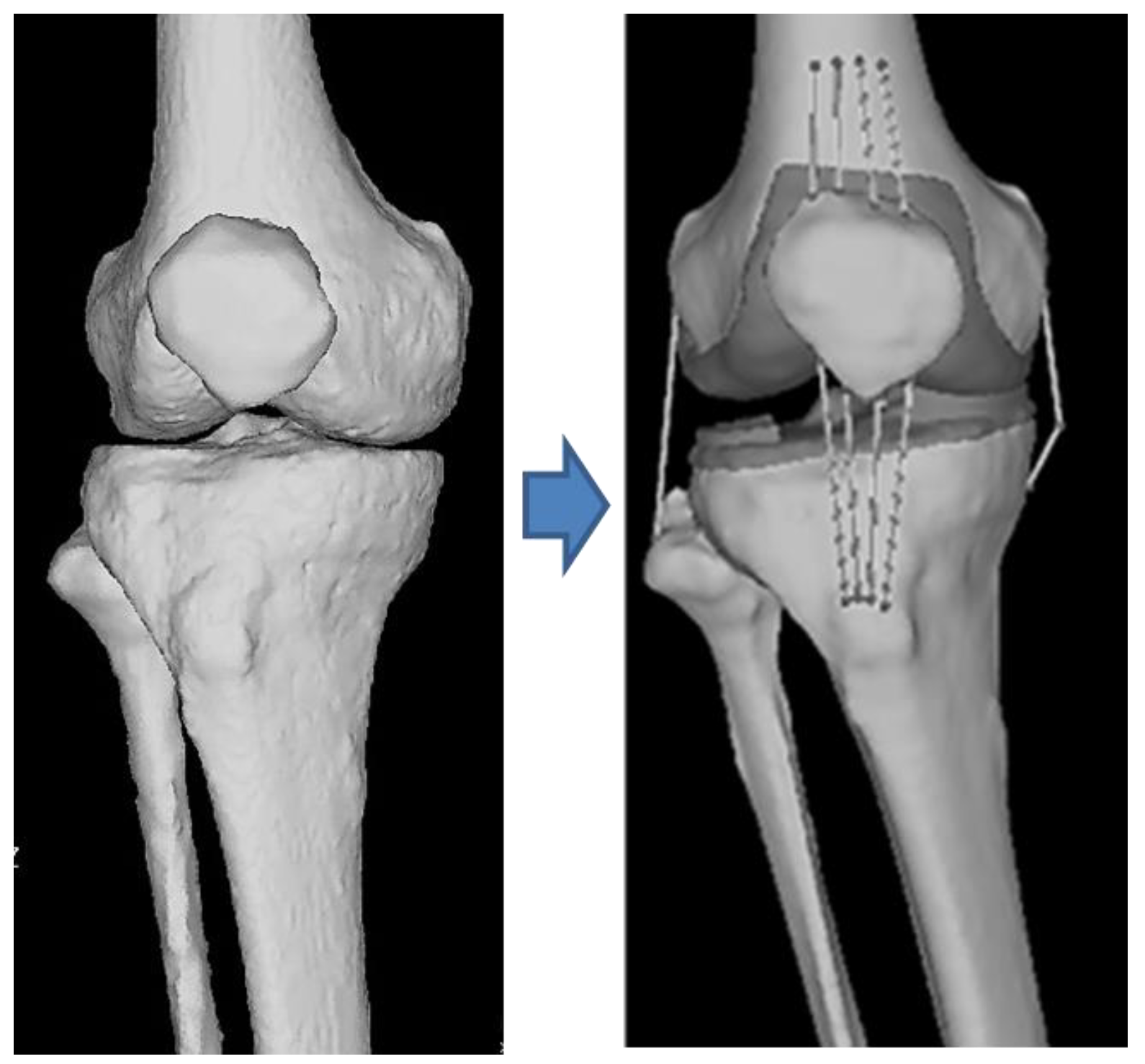 Jfmk 08 00015 g001 Jfmk 08 00015 g001