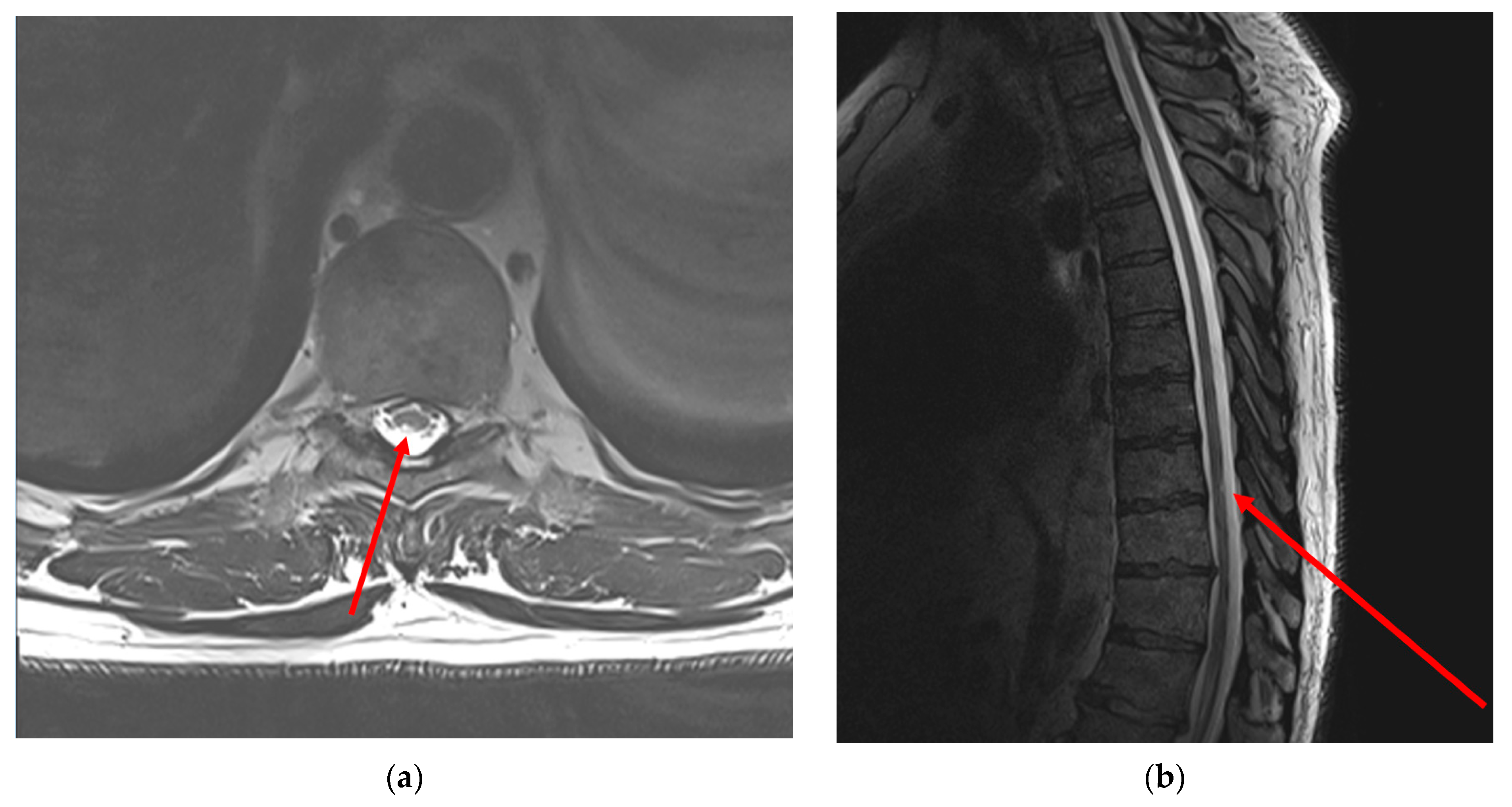 Functional Electrical Stimulation Therapy: Mechanisms for Recovery of  Function Following Spinal Cord Injury and Stroke | SpringerLink