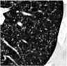 Jimaging 02 00019 i005
