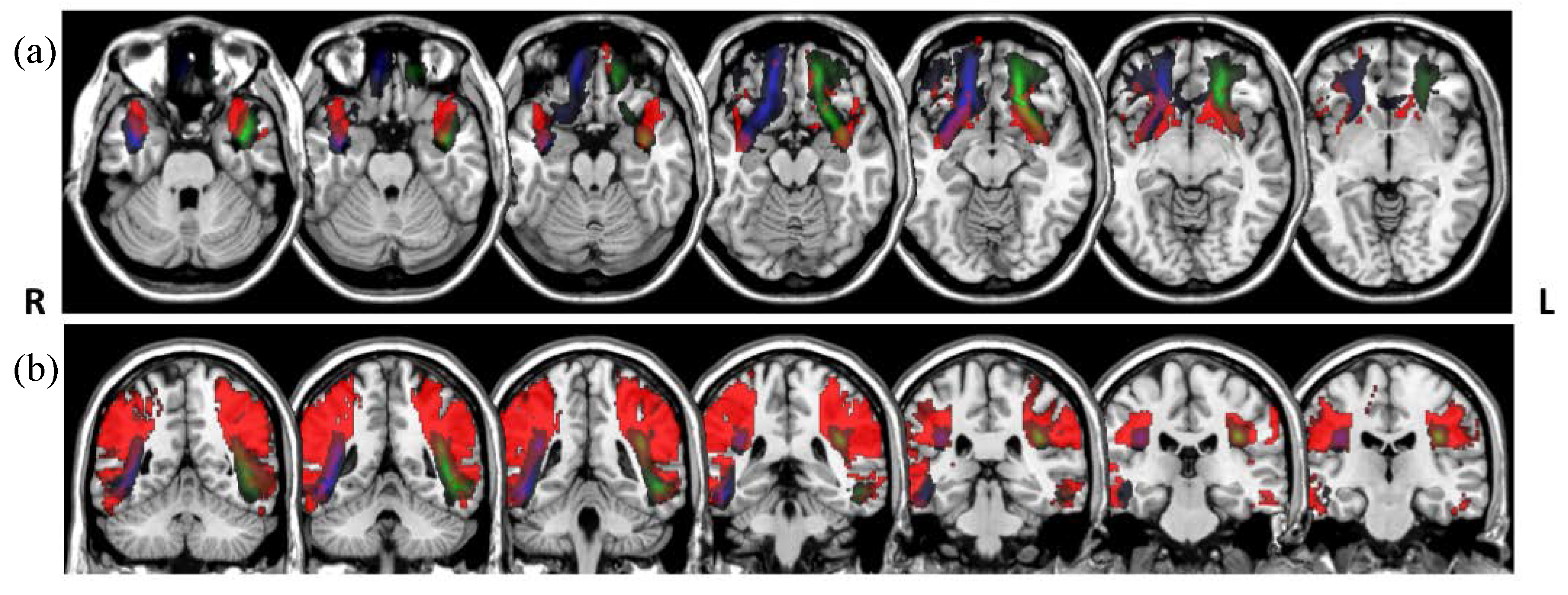 Jimaging 04 00008 g005 Jimaging 04 00008 g005