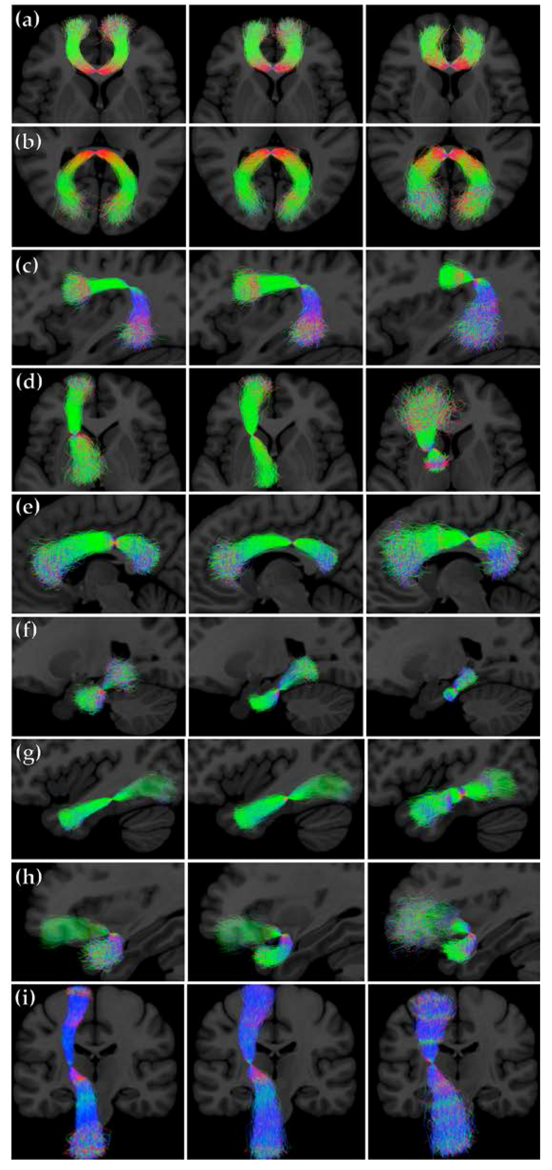 Jimaging 04 00008 g006 Jimaging 04 00008 g006