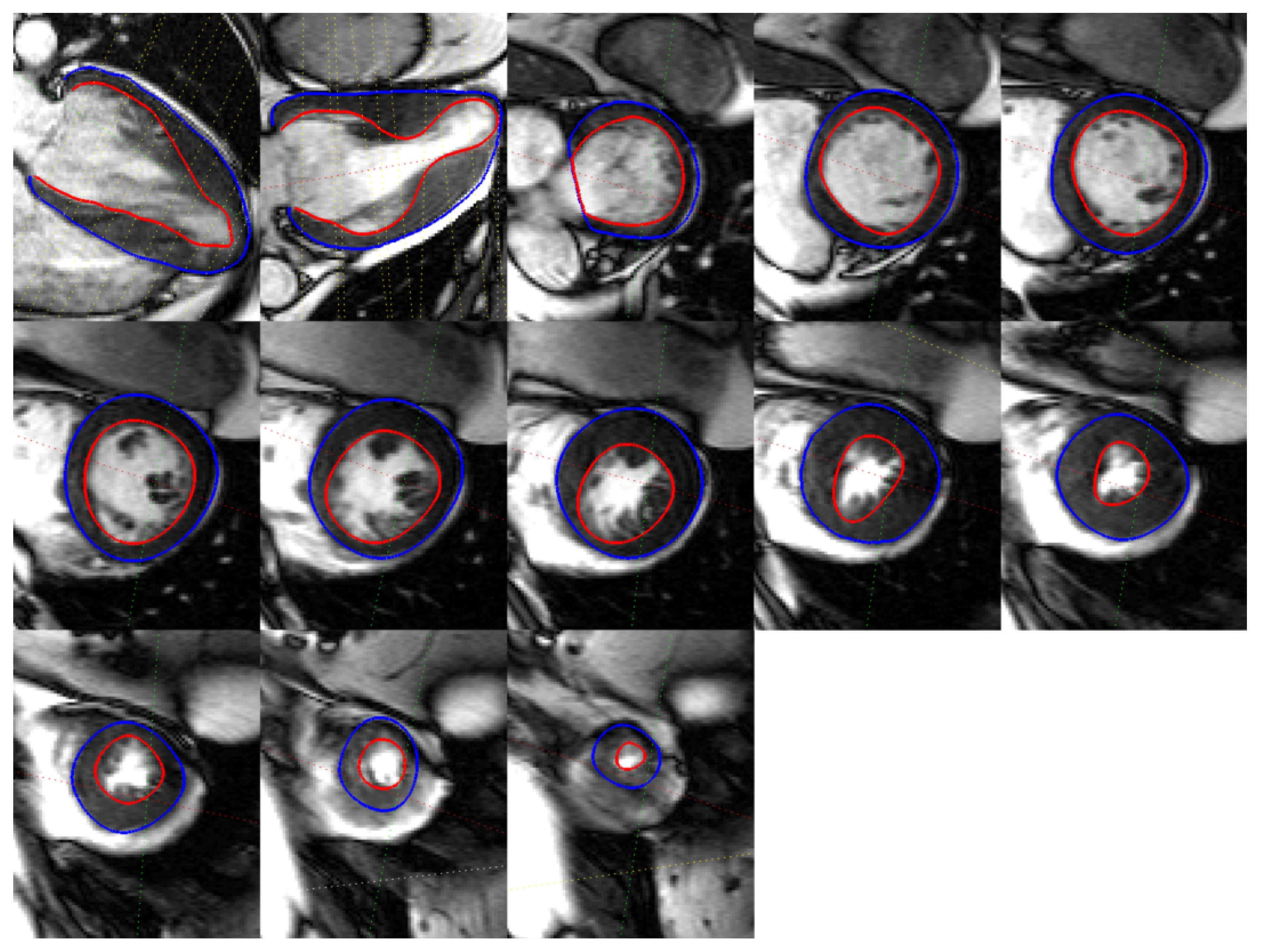 Jimaging 04 00016 g008