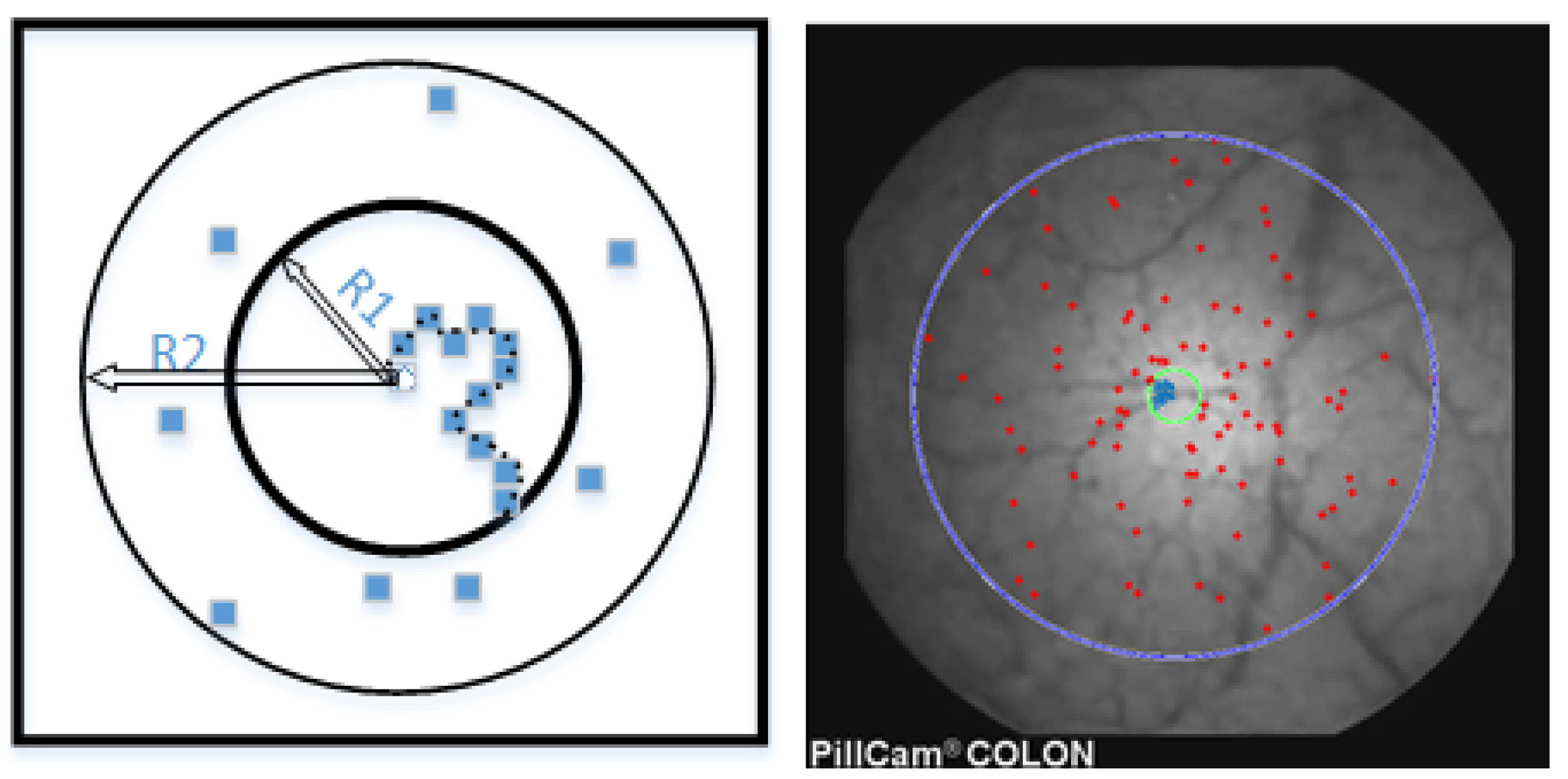Jimaging 04 00075 g001 Jimaging 04 00075 g001