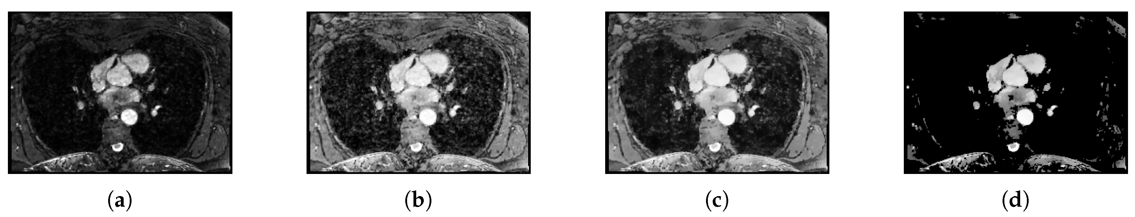 Jimaging 04 00124 g002 Jimaging 04 00124 g002