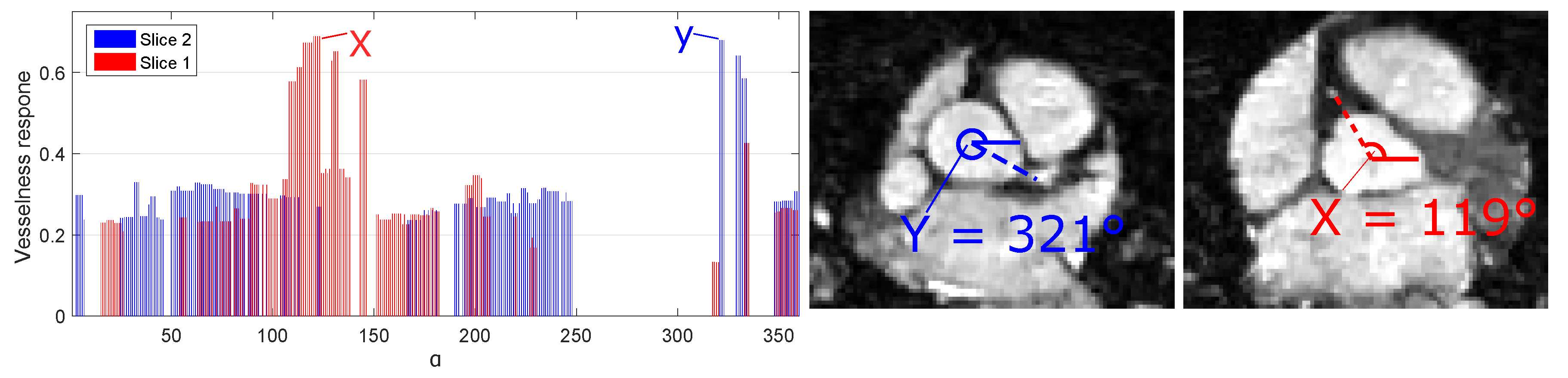 Jimaging 04 00124 g003 Jimaging 04 00124 g003
