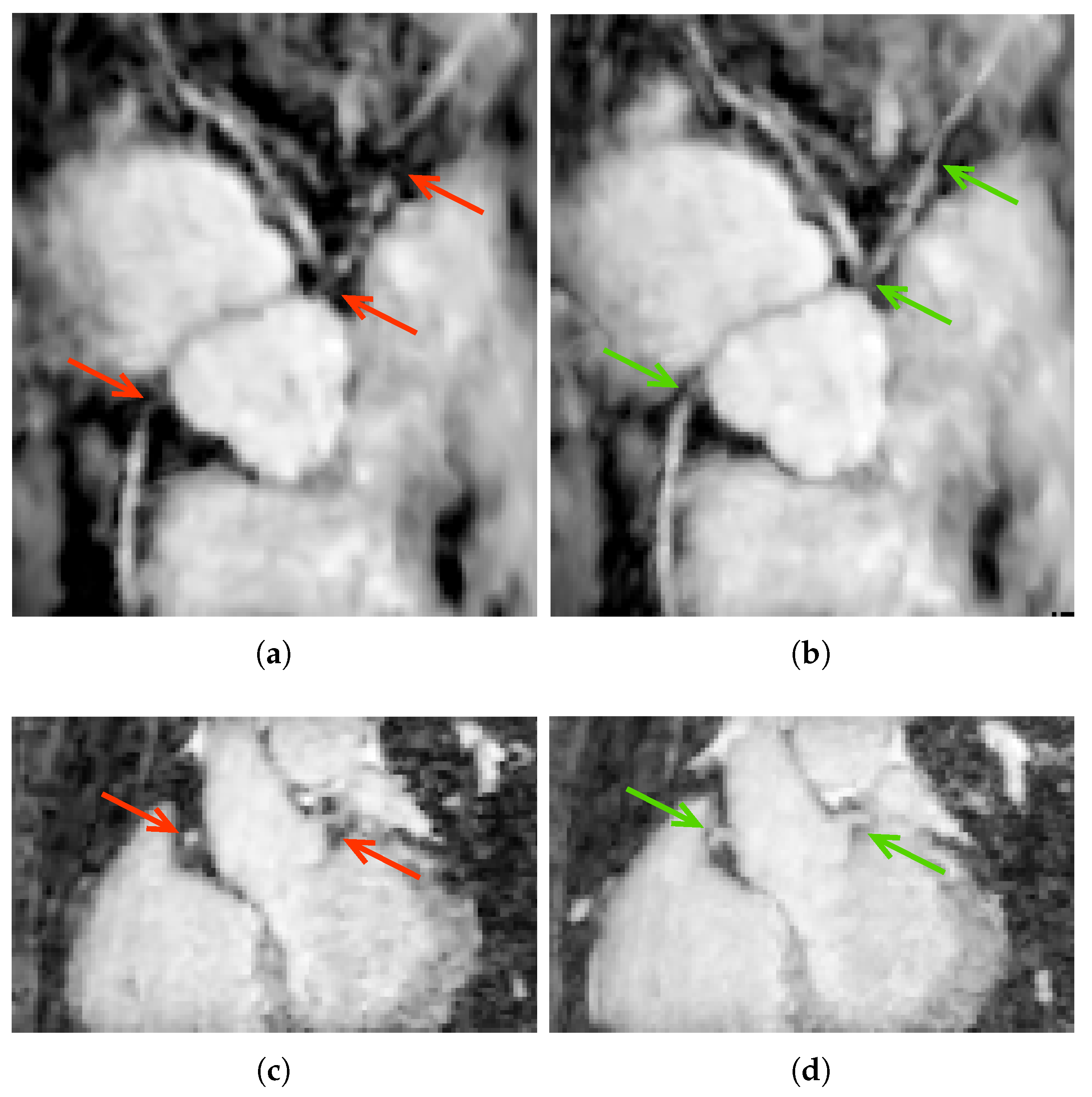 Jimaging 04 00124 g005 Jimaging 04 00124 g005