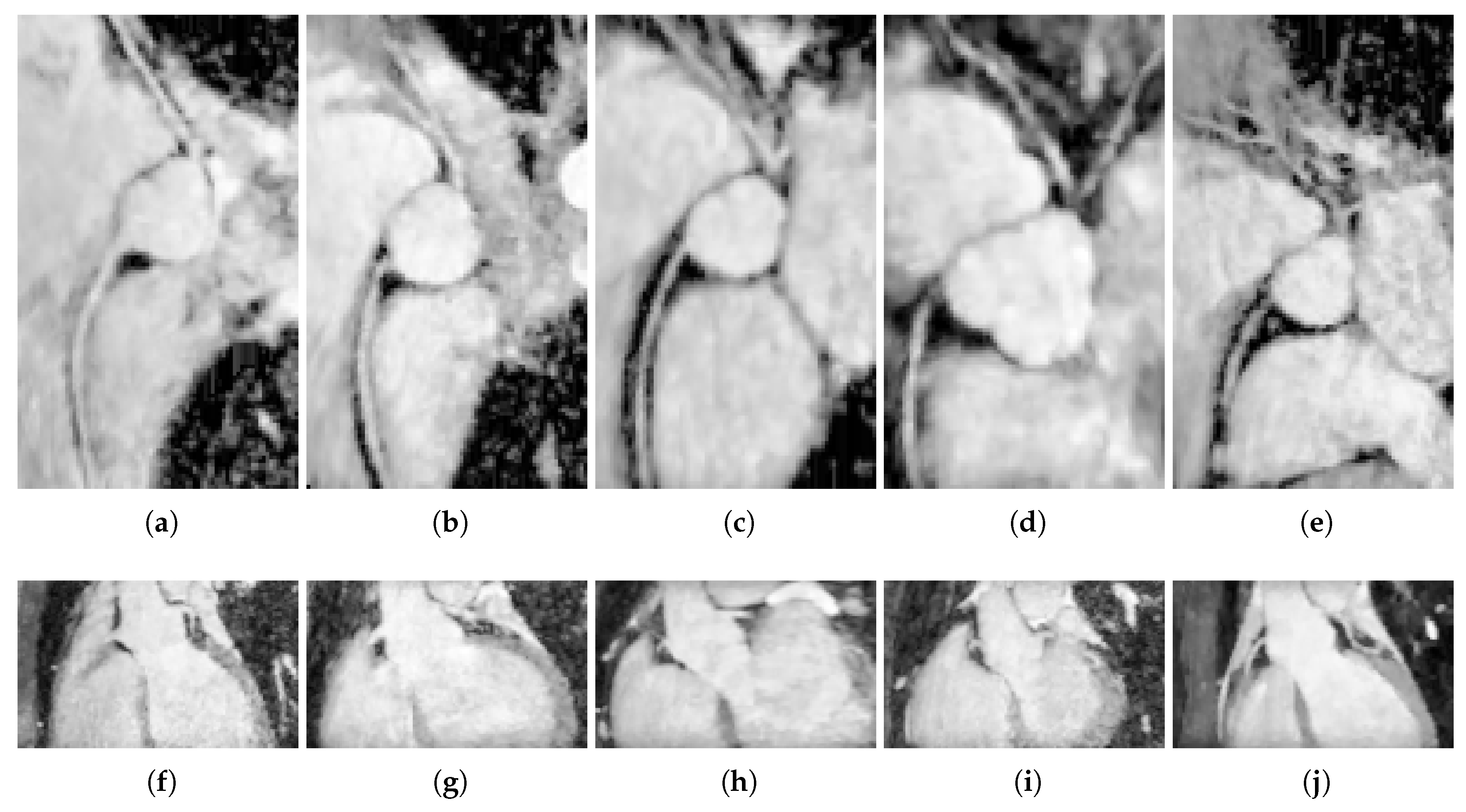 Jimaging 04 00124 g006 Jimaging 04 00124 g006