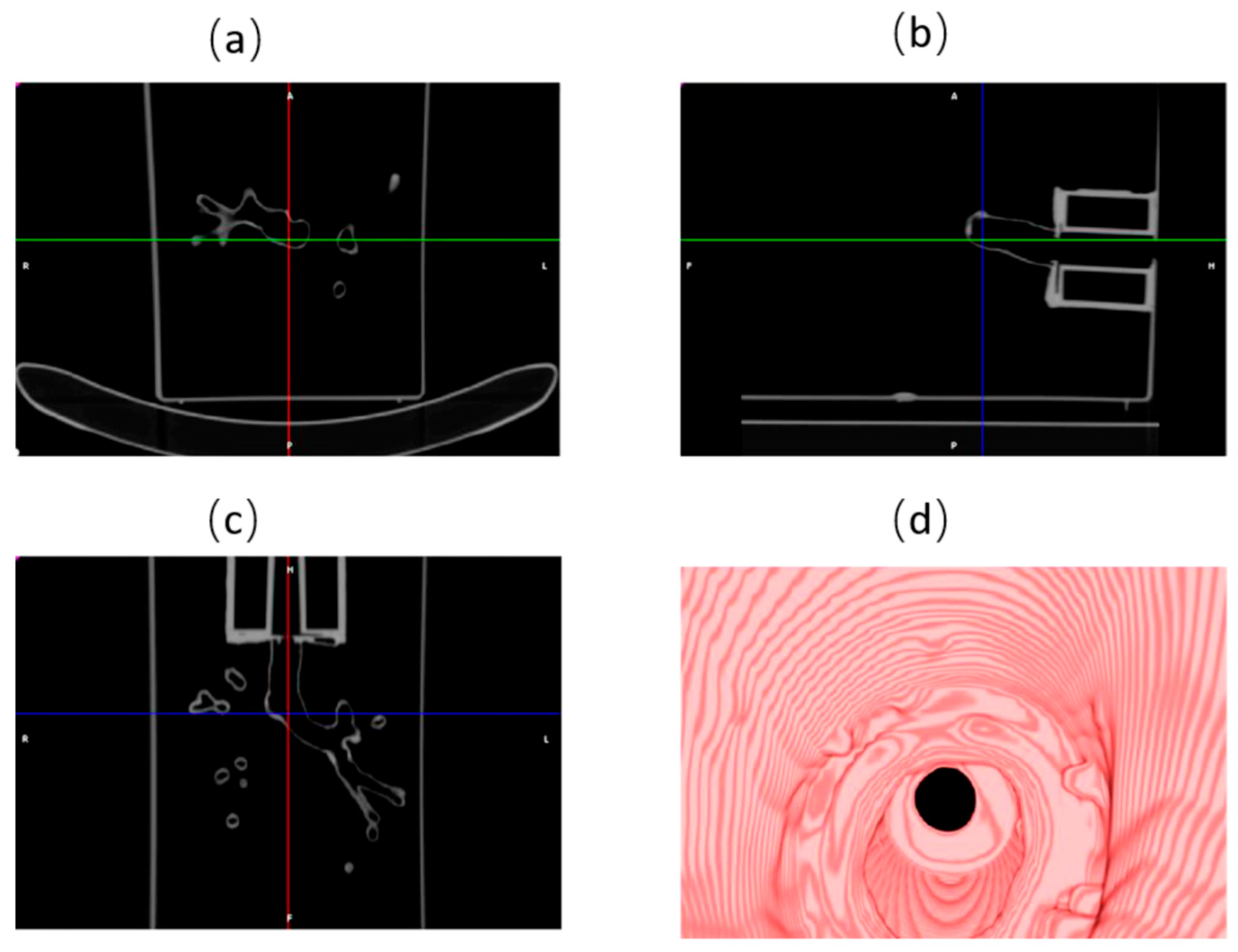 Jimaging 04 00135 g002 Jimaging 04 00135 g002