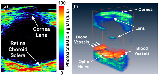 J Imaging Free Full Text Photoacoustic Ophthalmoscopy Principle Application And Future Directions Html