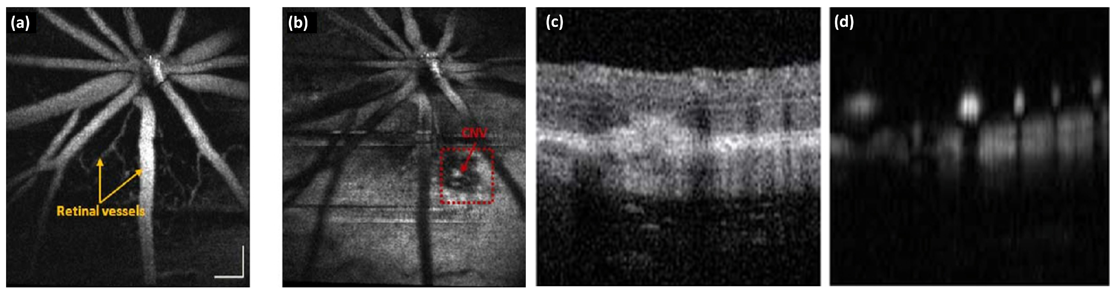 Jimaging 04 00149 g008 Jimaging 04 00149 g008