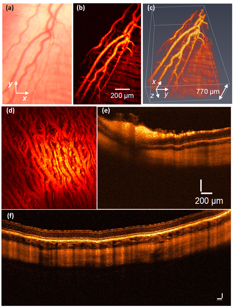 Jimaging 04 00149 g009 Jimaging 04 00149 g009