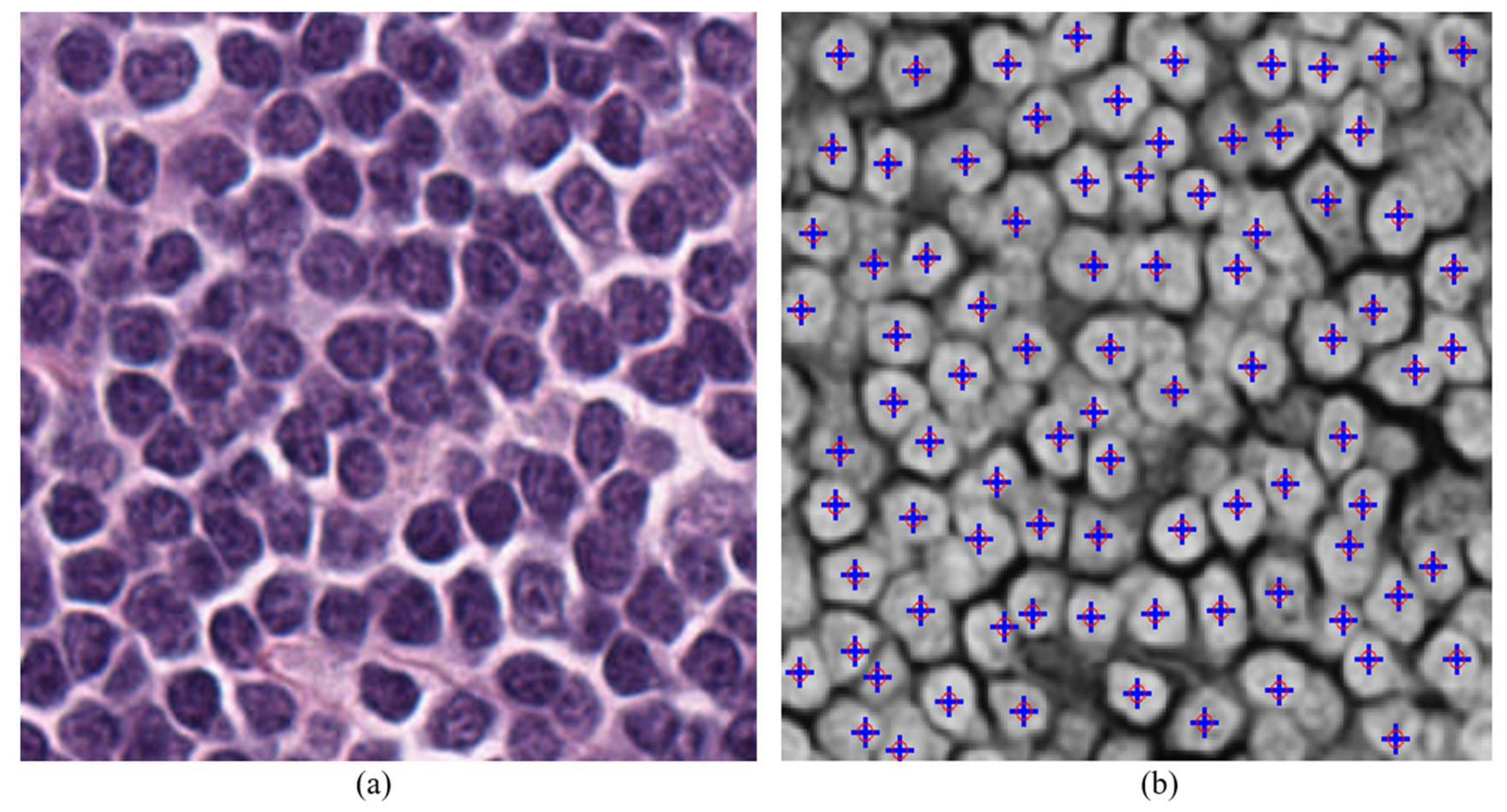 Jimaging 05 00021 g013 550