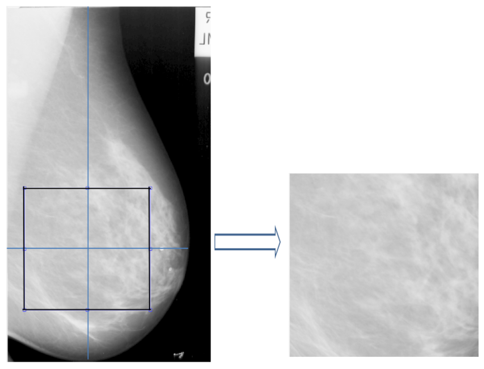 Jimaging 05 00024 g002 Jimaging 05 00024 g002