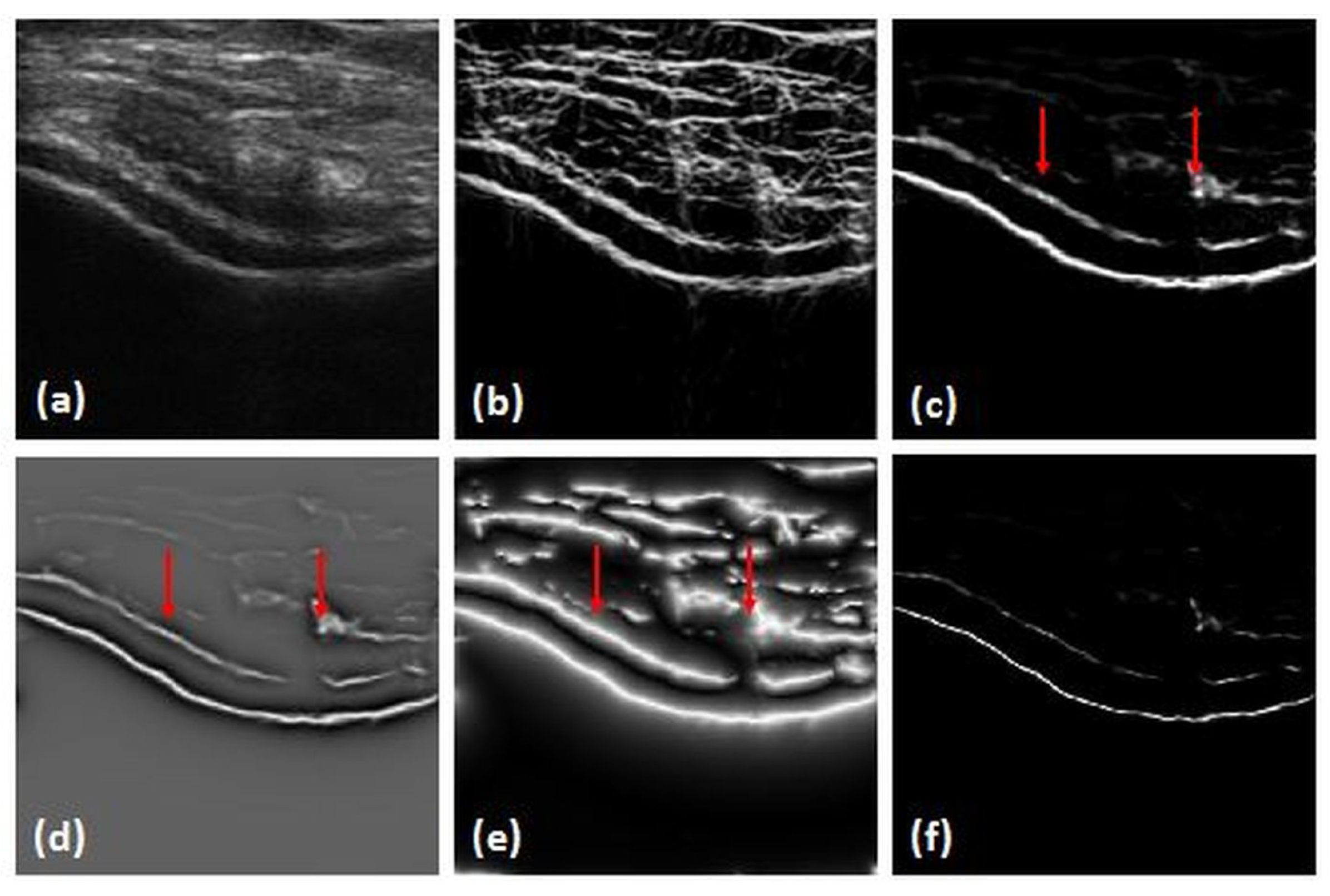 Jimaging 05 00043 g003 Jimaging 05 00043 g003