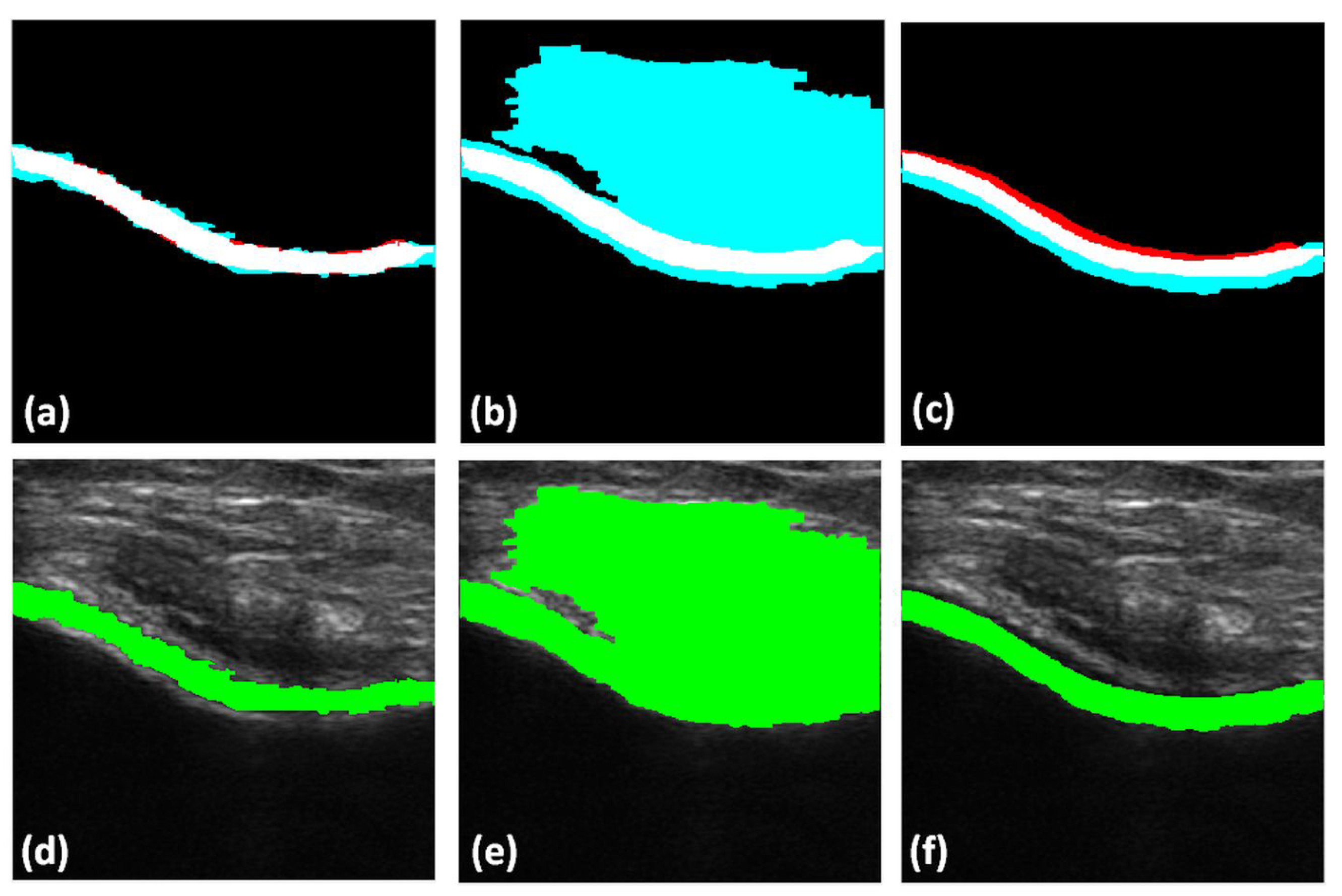 Jimaging 05 00043 g008 Jimaging 05 00043 g008