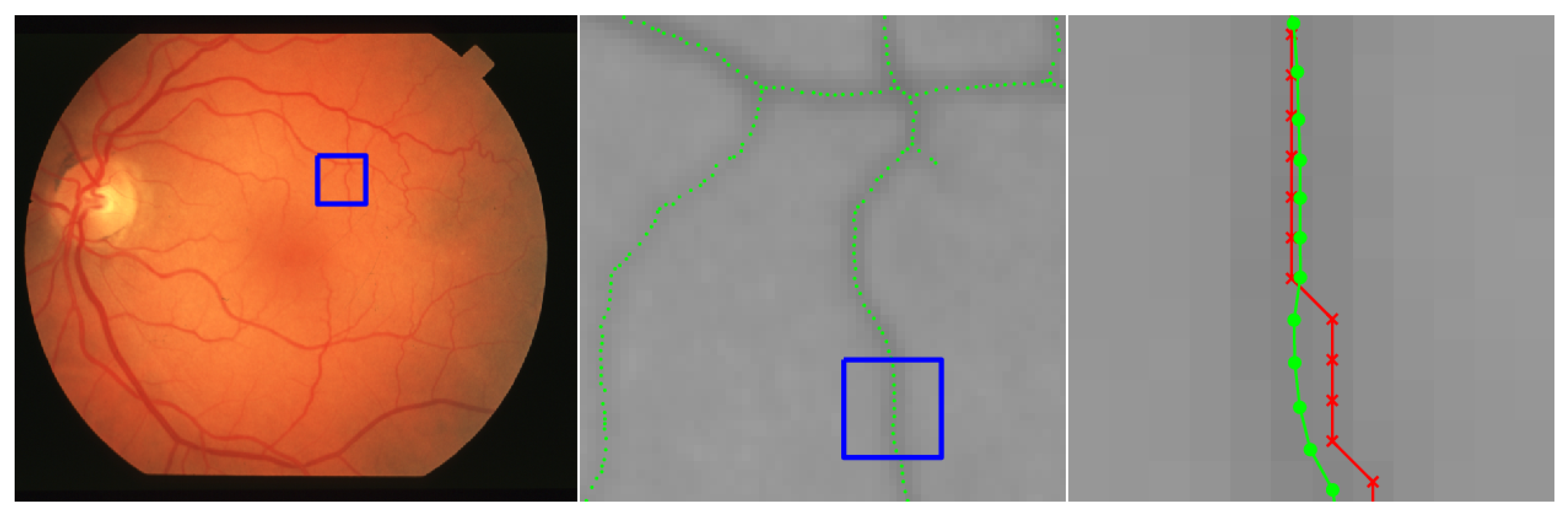 Jimaging 06 00033 g016 Jimaging 06 00033 g016