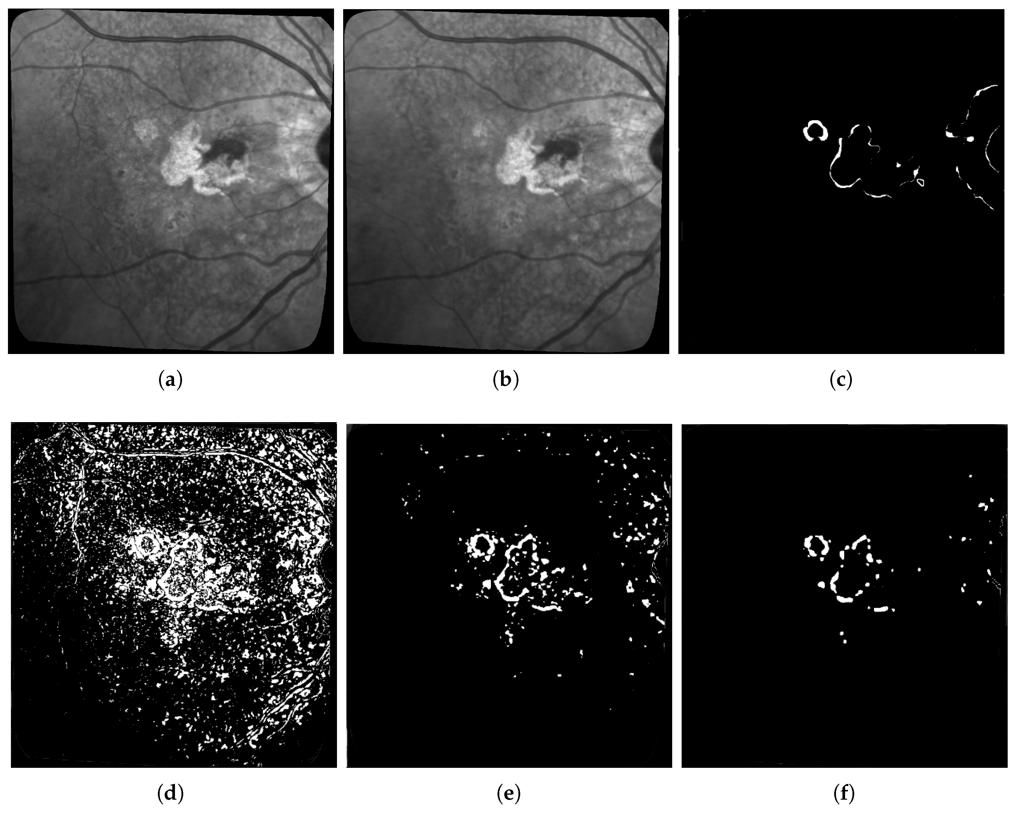 Jimaging 06 00057 g011