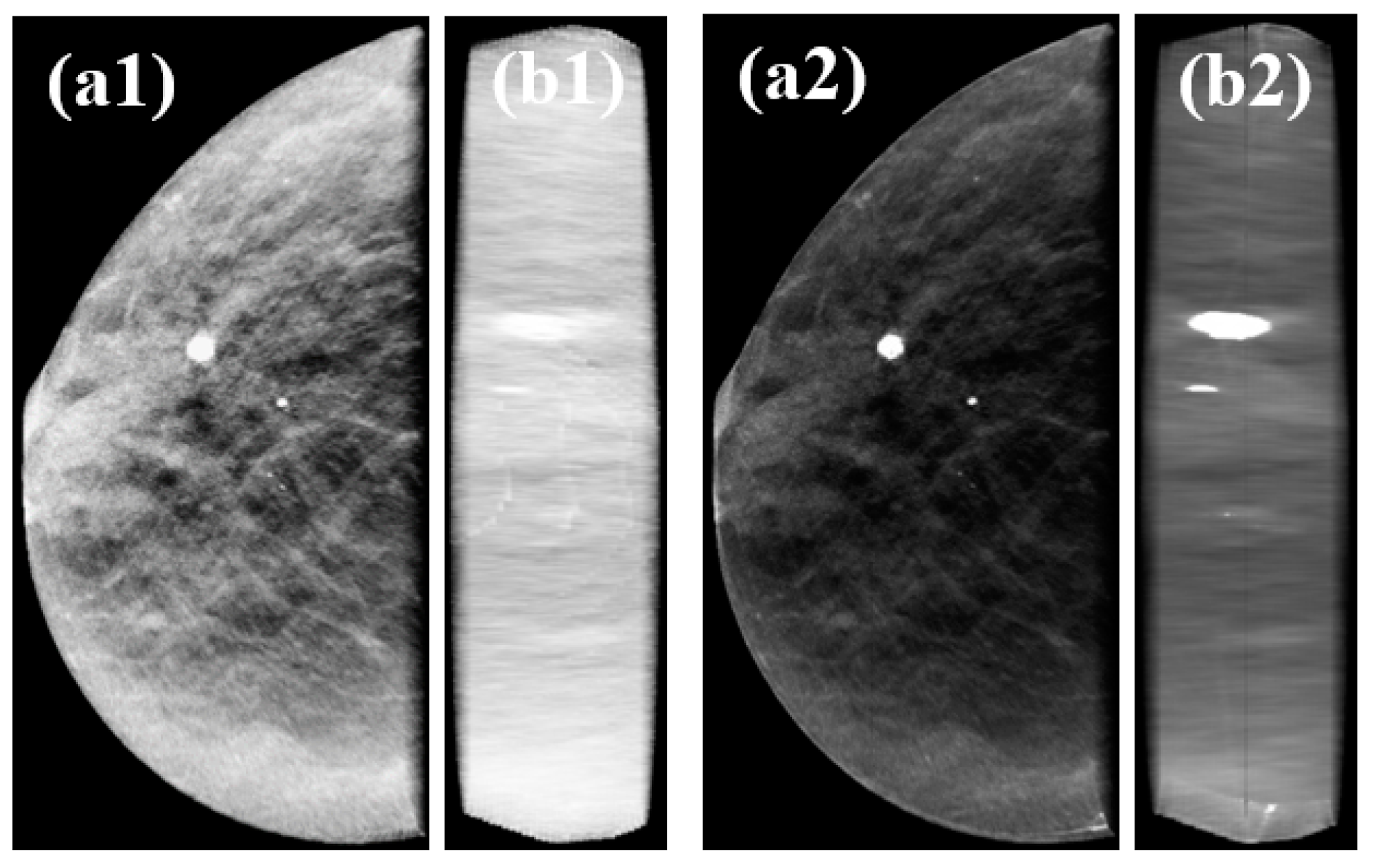 Jimaging 06 00064 g013 Jimaging 06 00064 g013