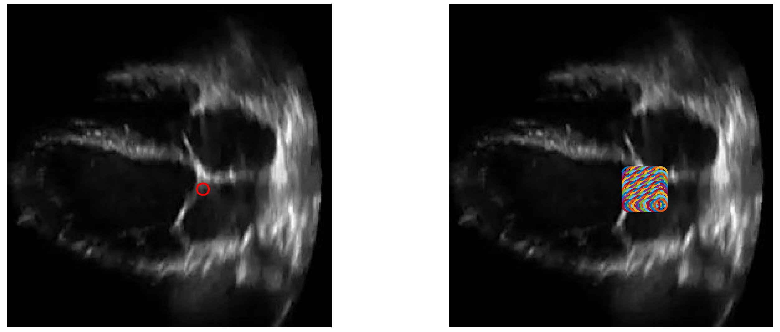 Jimaging 06 00093 g015 Jimaging 06 00093 g015