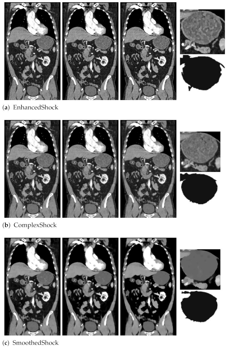 Jimaging 07 00056 g009 Jimaging 07 00056 g009