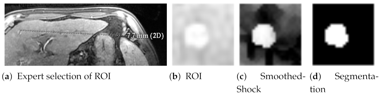 Jimaging 07 00056 g010 Jimaging 07 00056 g010