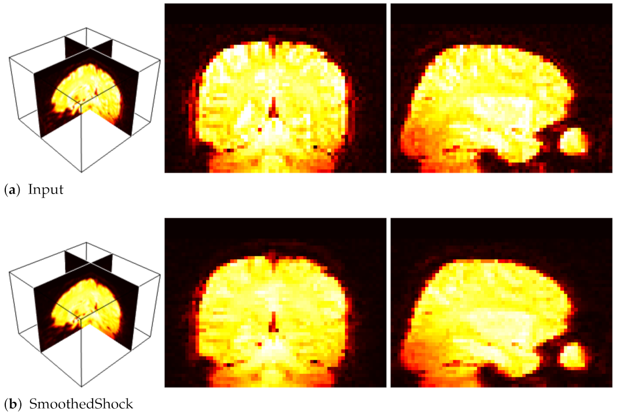 Jimaging 07 00056 g012 Jimaging 07 00056 g012