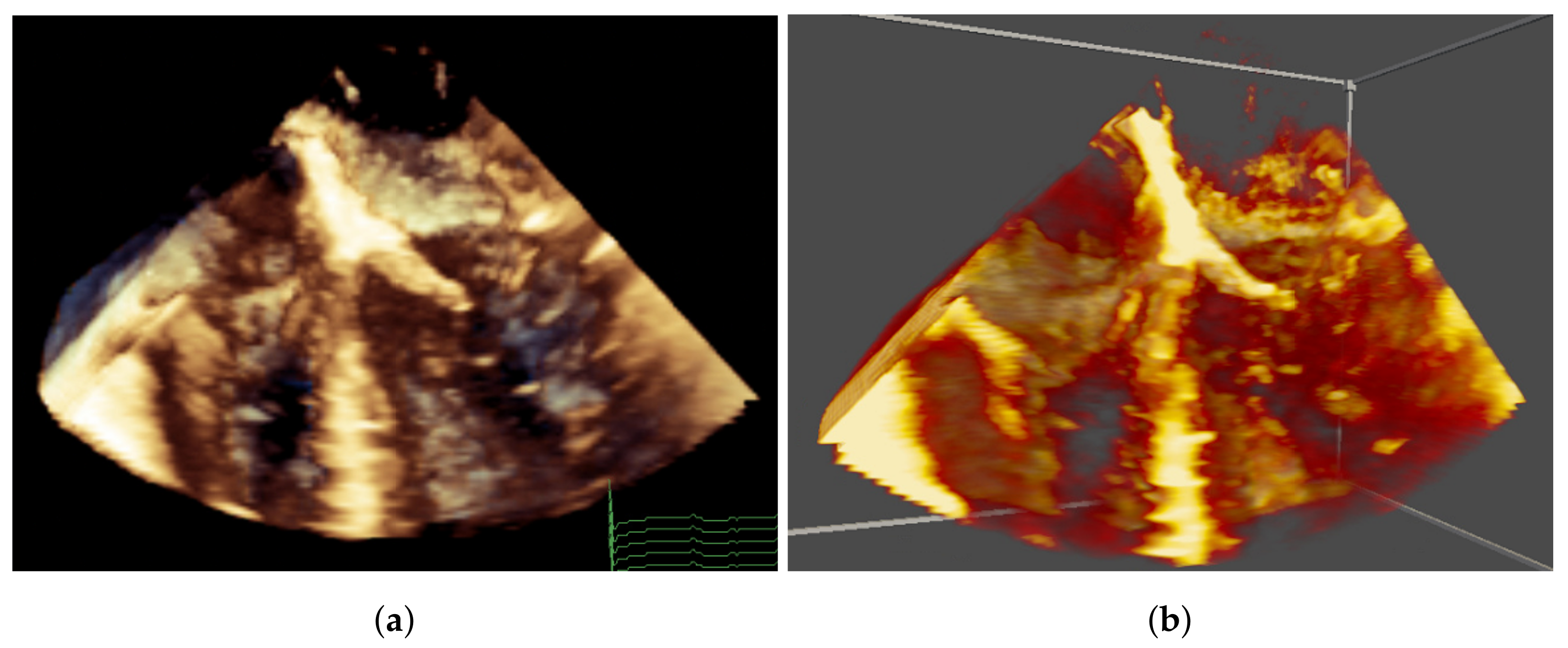 Jimaging 07 00151 g005 550