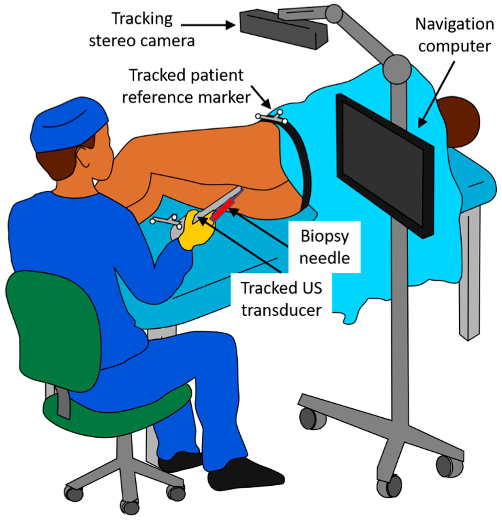 Prostate Biopsy Gun prostate-biopsy-gun