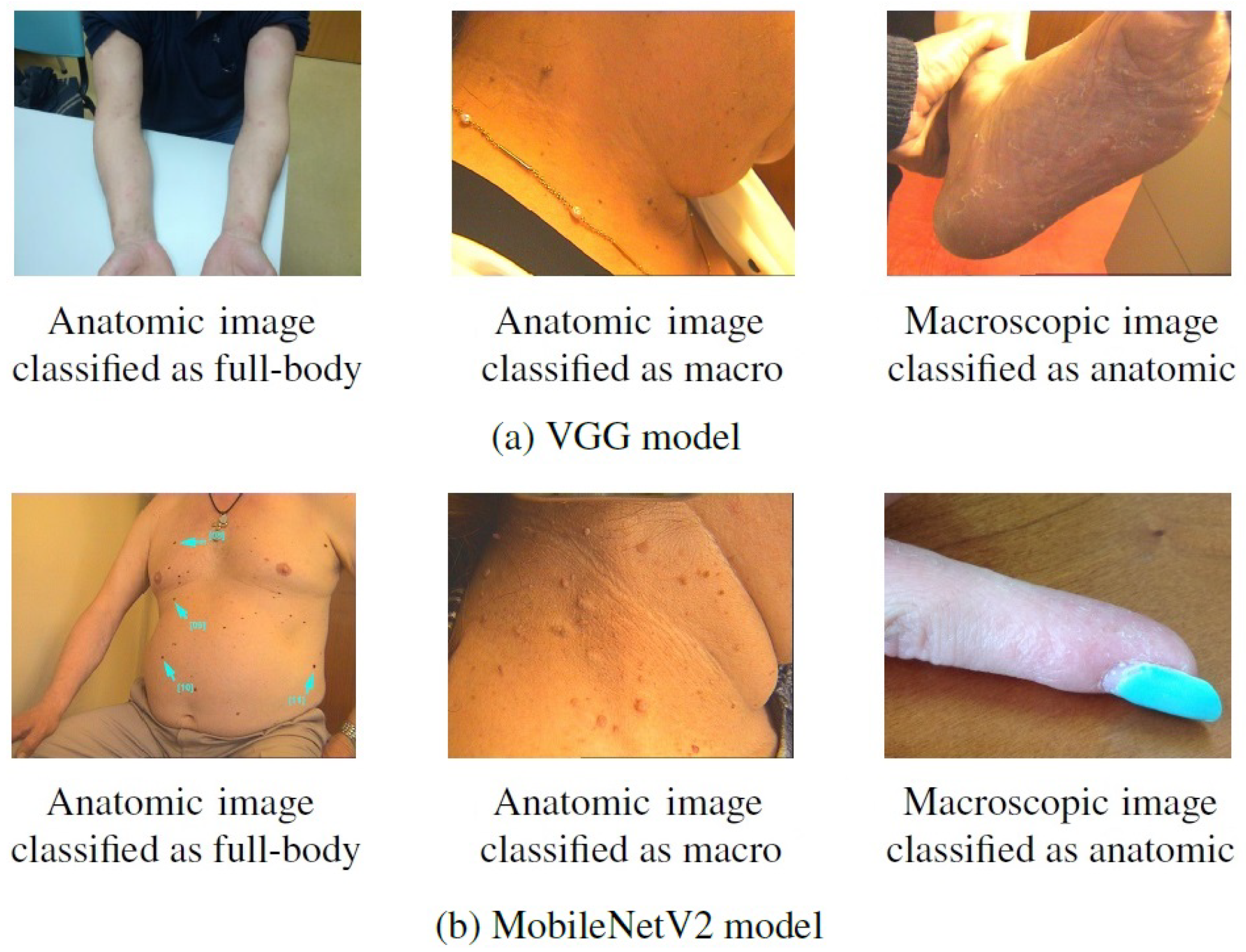 Jimaging 07 00180 g007 550