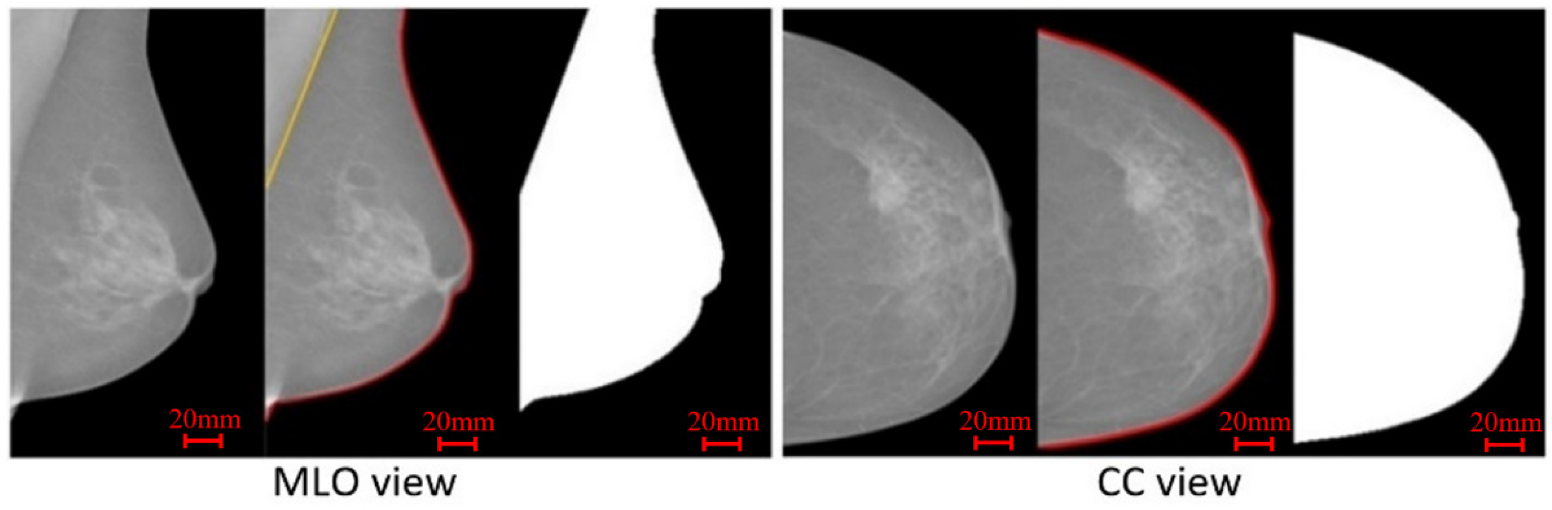 Jimaging 07 00205 g004 Jimaging 07 00205 g004