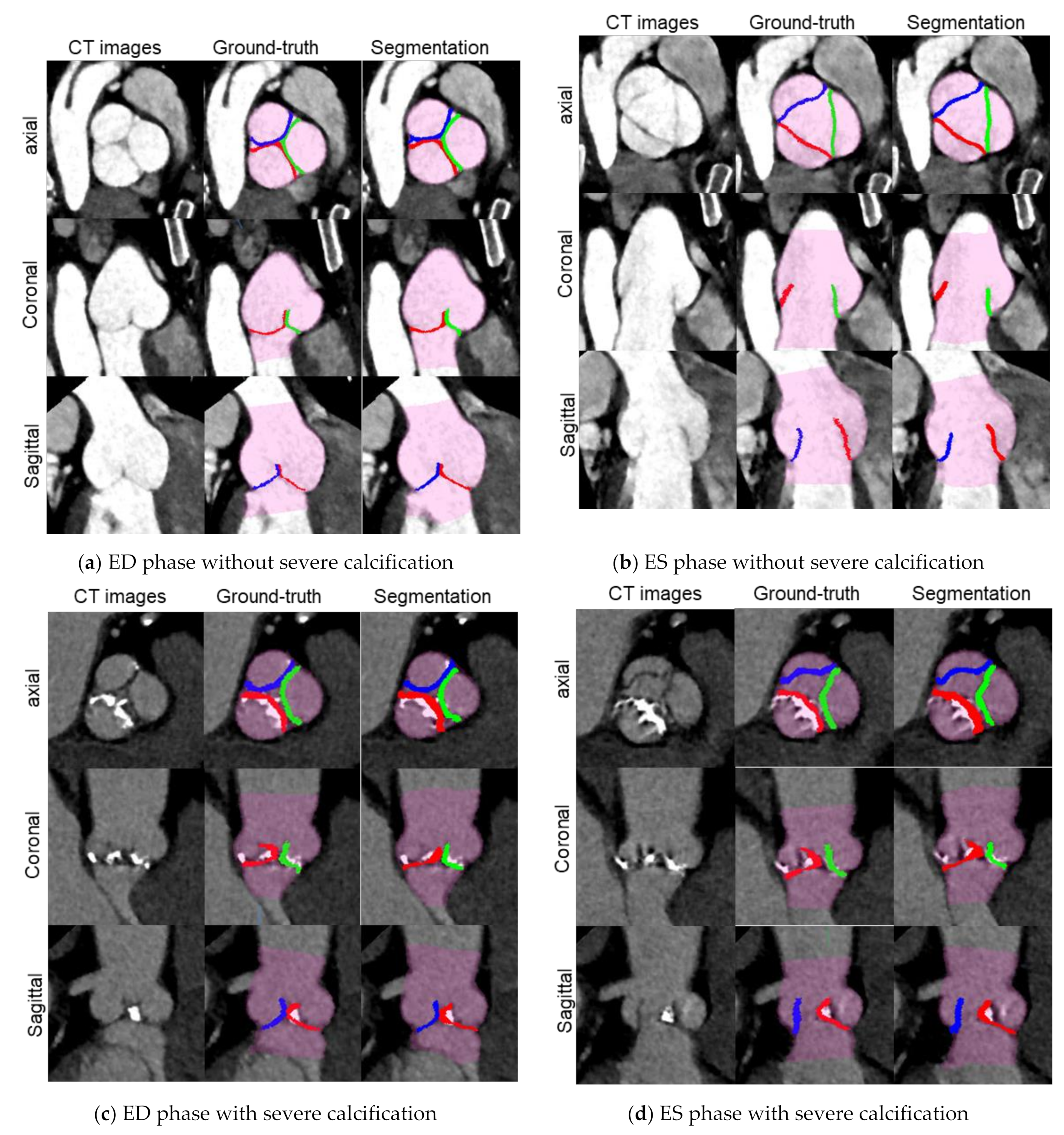 Jimaging 08 00011 g005