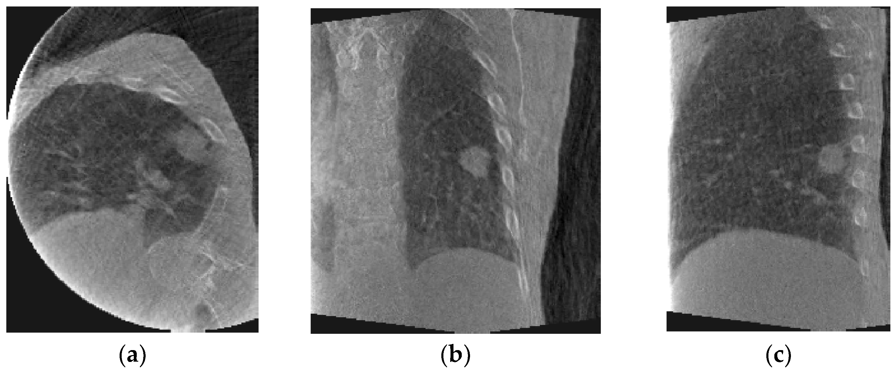 Jimaging 08 00017 g005 Jimaging 08 00017 g005