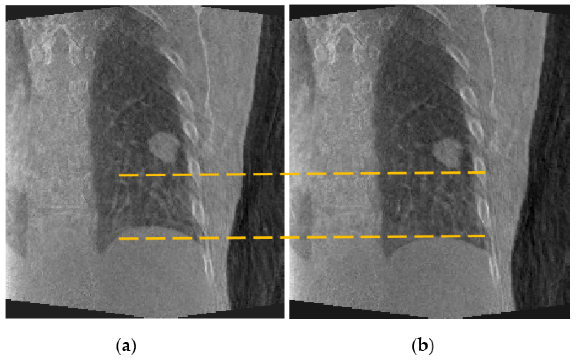 Jimaging 08 00017 g006 Jimaging 08 00017 g006
