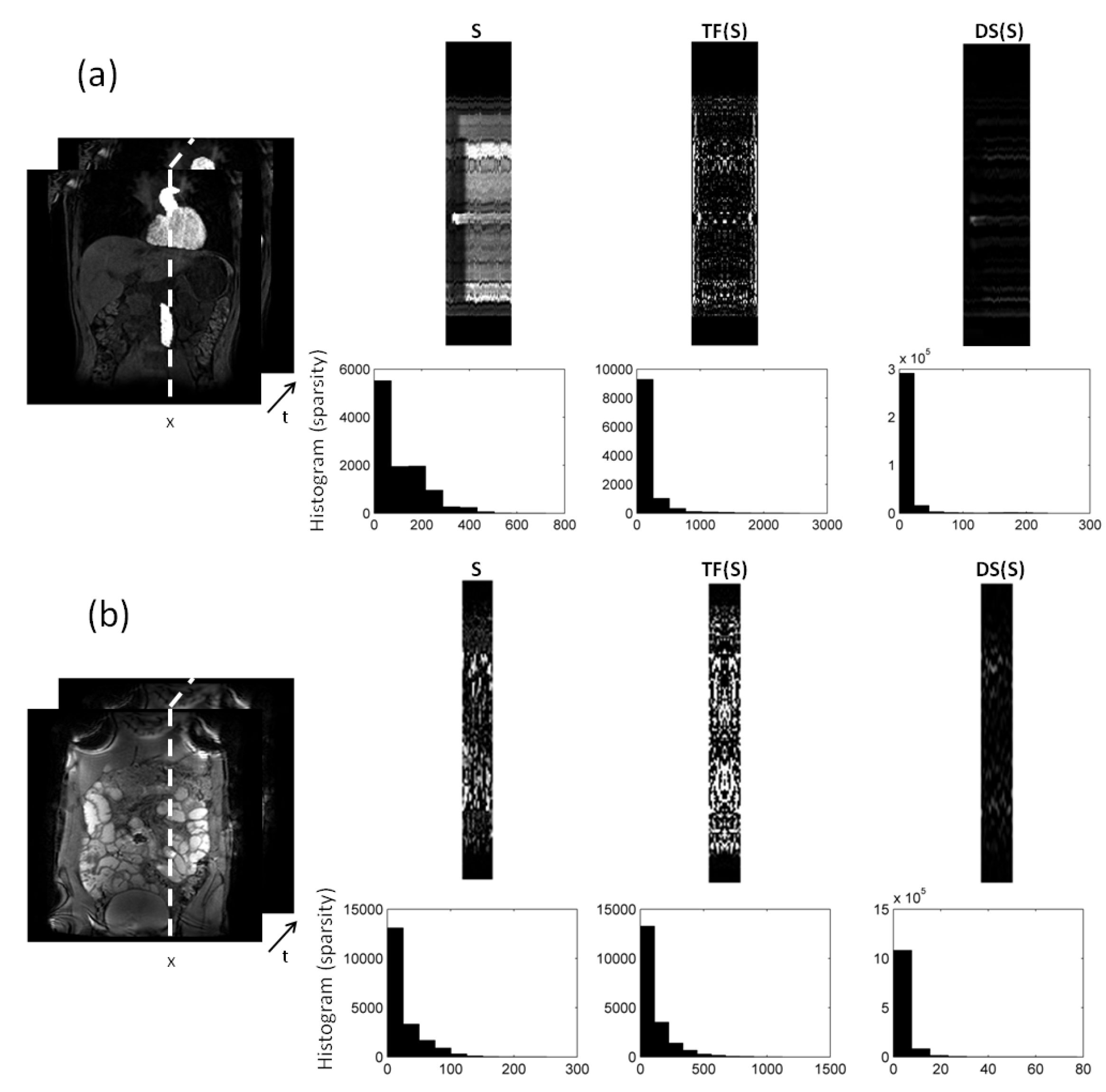 Jimaging 08 00029 g002 550