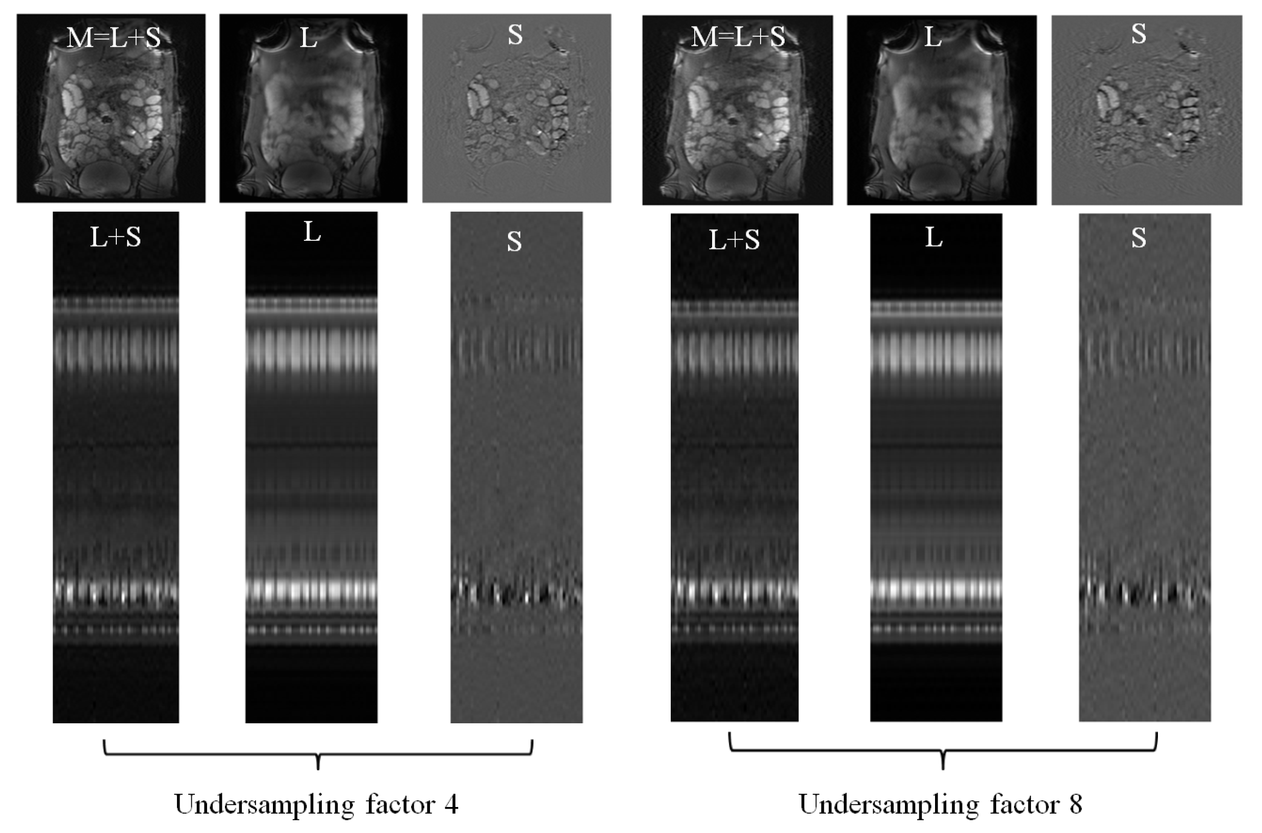 Jimaging 08 00029 g005 550