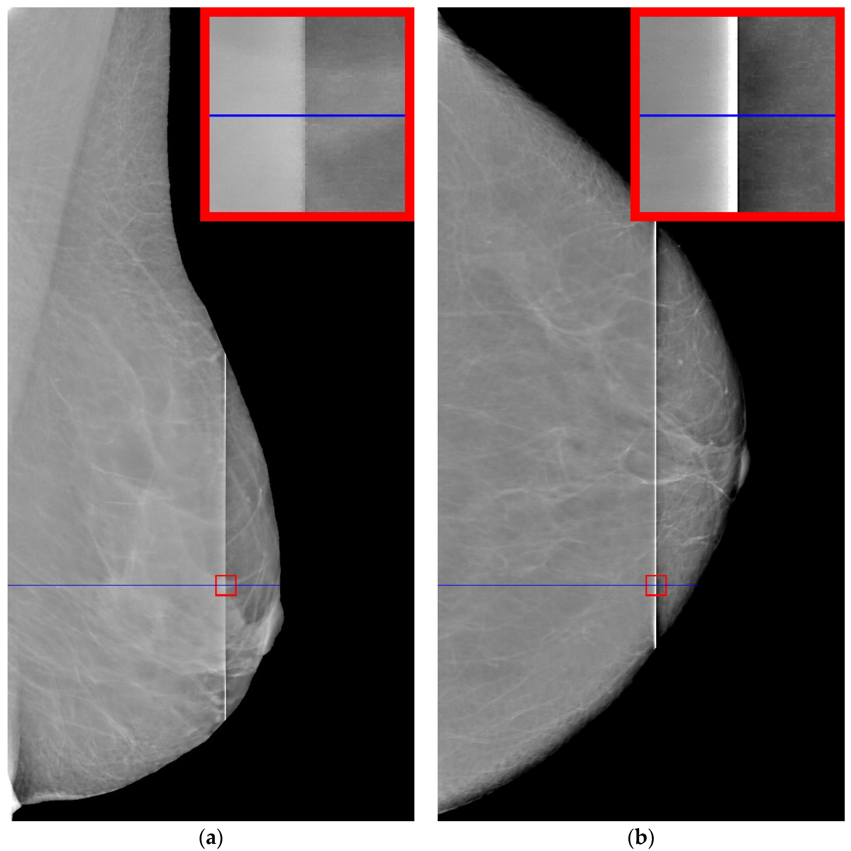 Jimaging 08 00128 g001 550