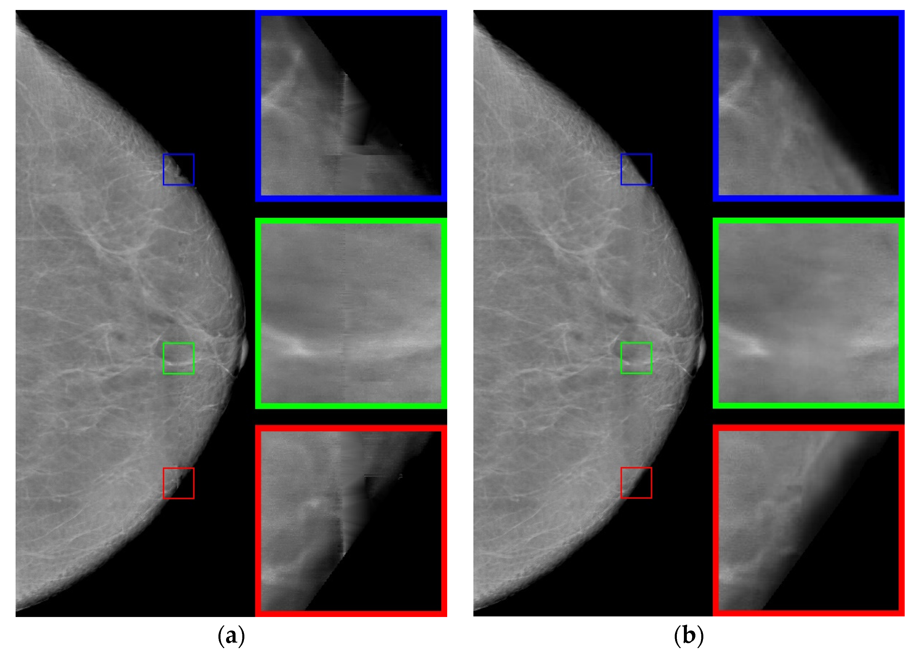 Jimaging 08 00128 g007 550