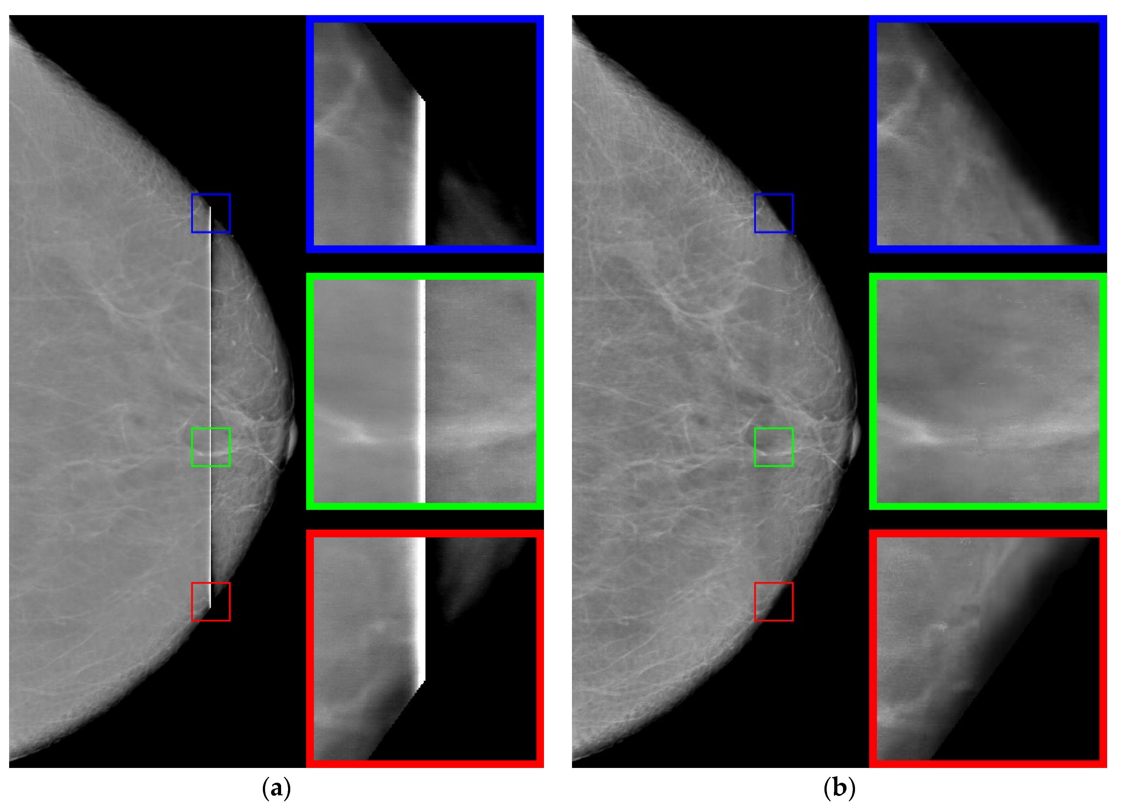 Jimaging 08 00128 g009 550