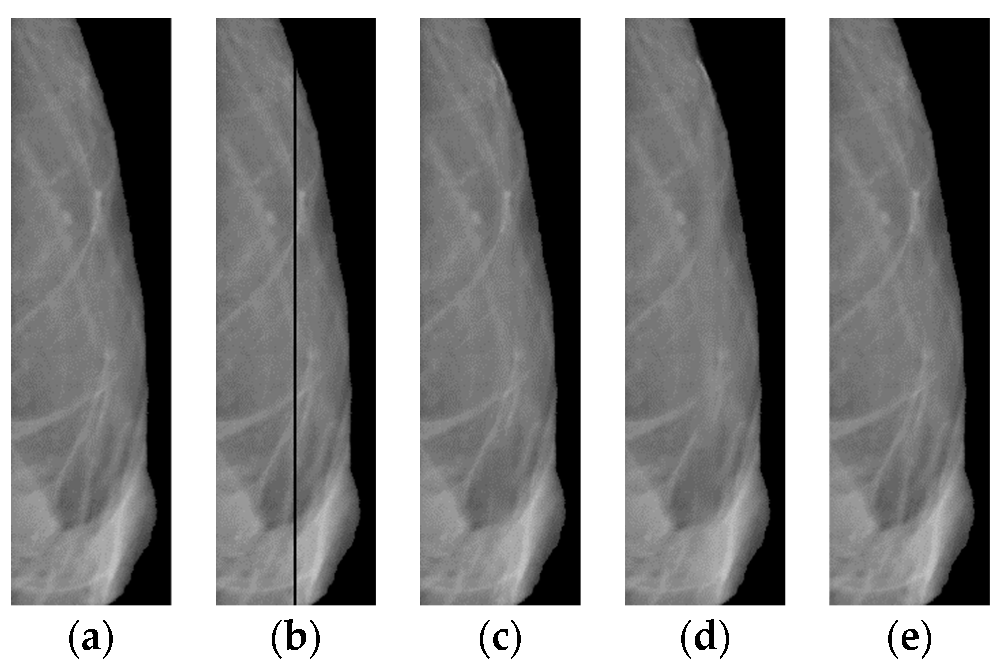 Jimaging 08 00128 g012 550