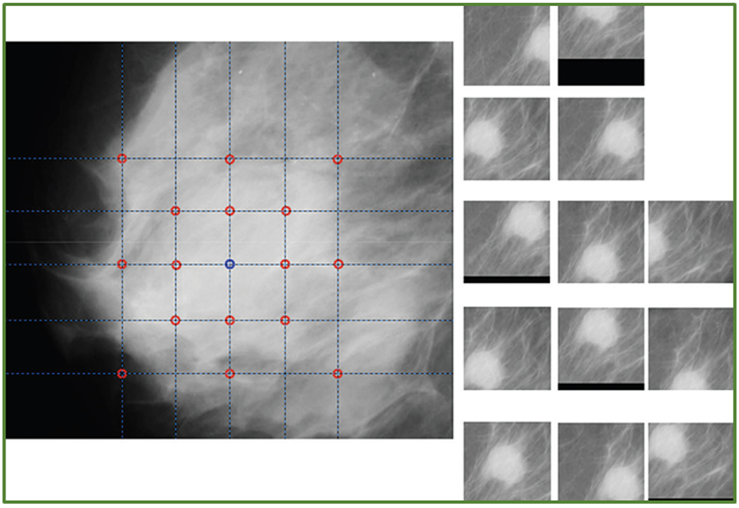Jimaging 08 00141 g005