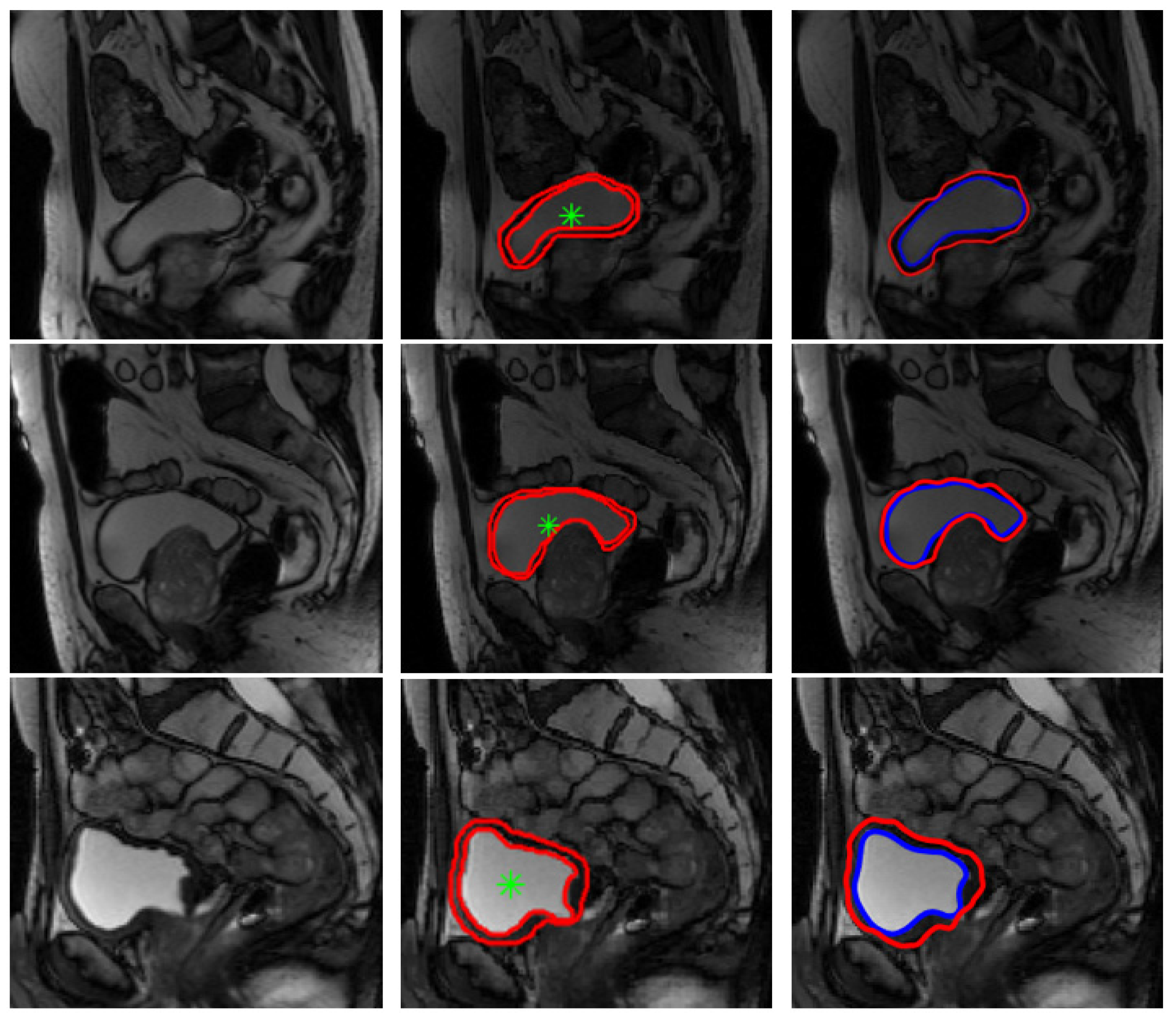 Jimaging 08 00151 g007a 550