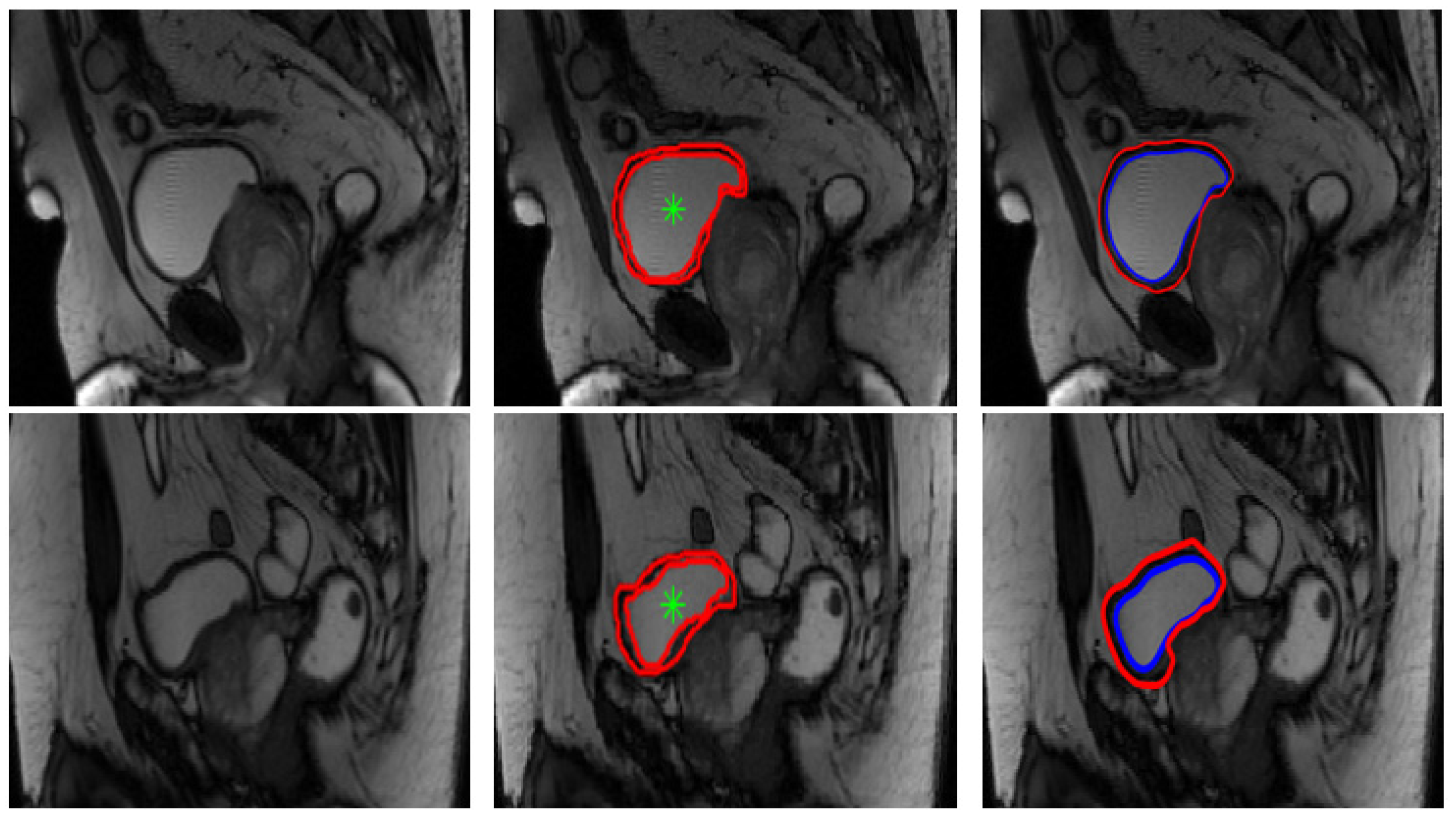 Jimaging 08 00151 g007b 550